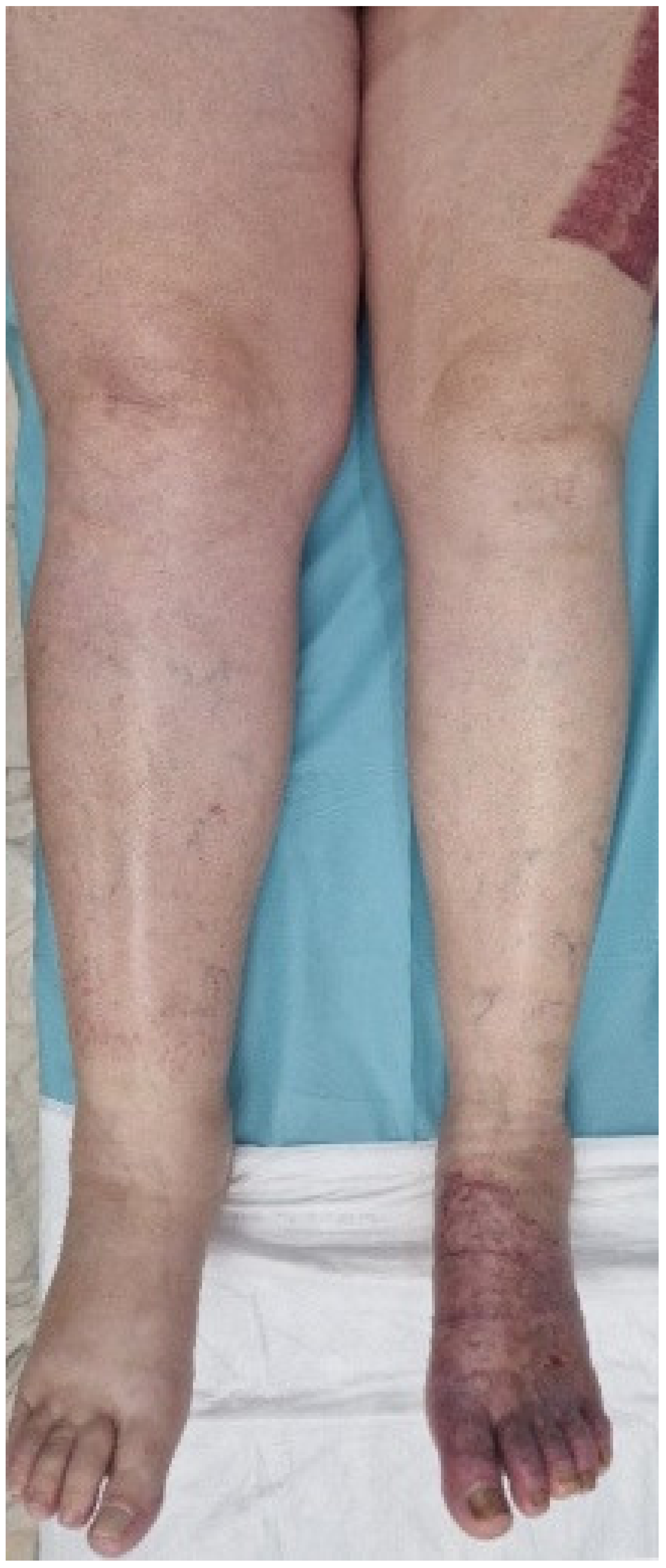 Medicina 60 00258 g003