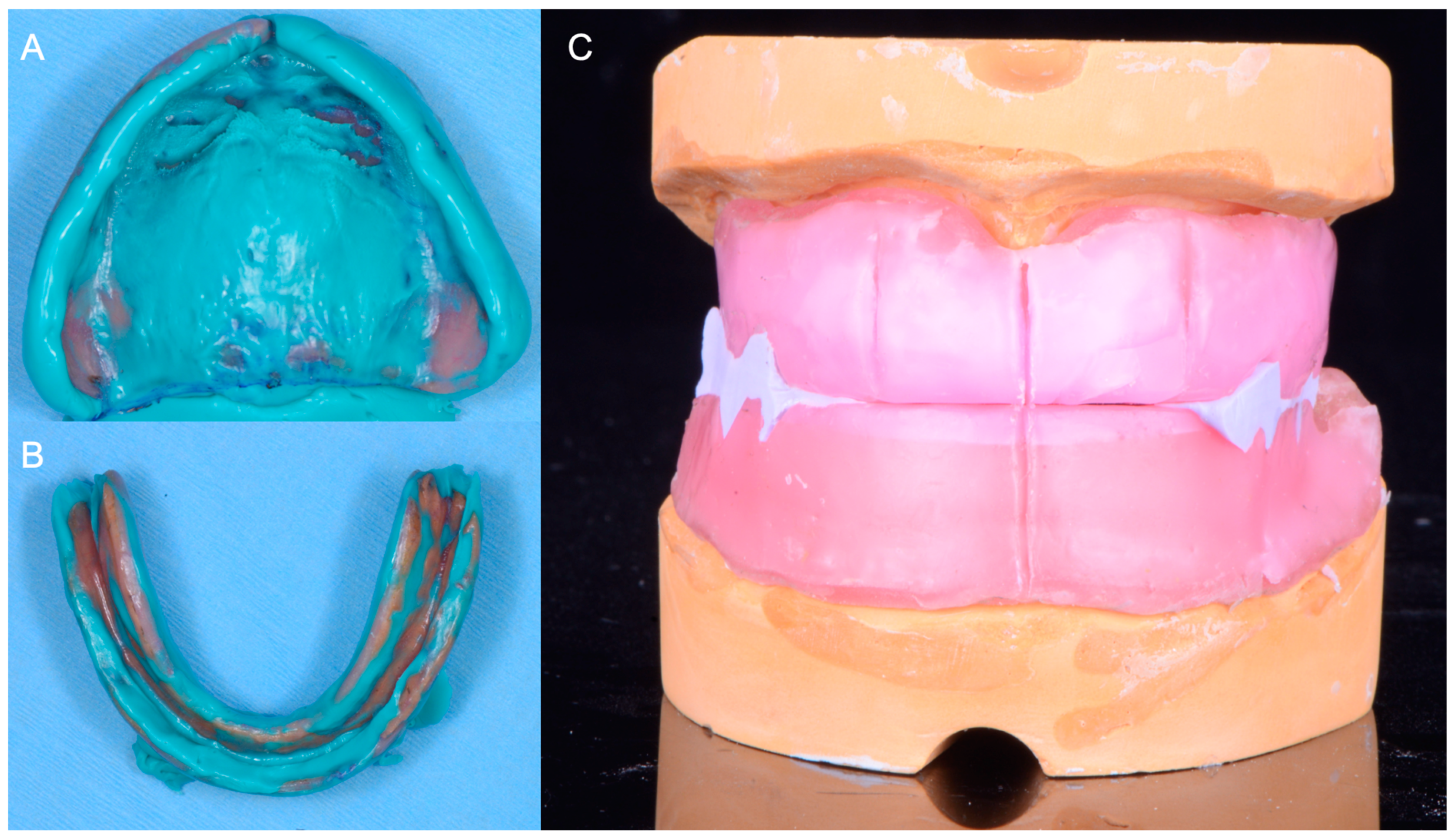 Medicina 60 00260 g003