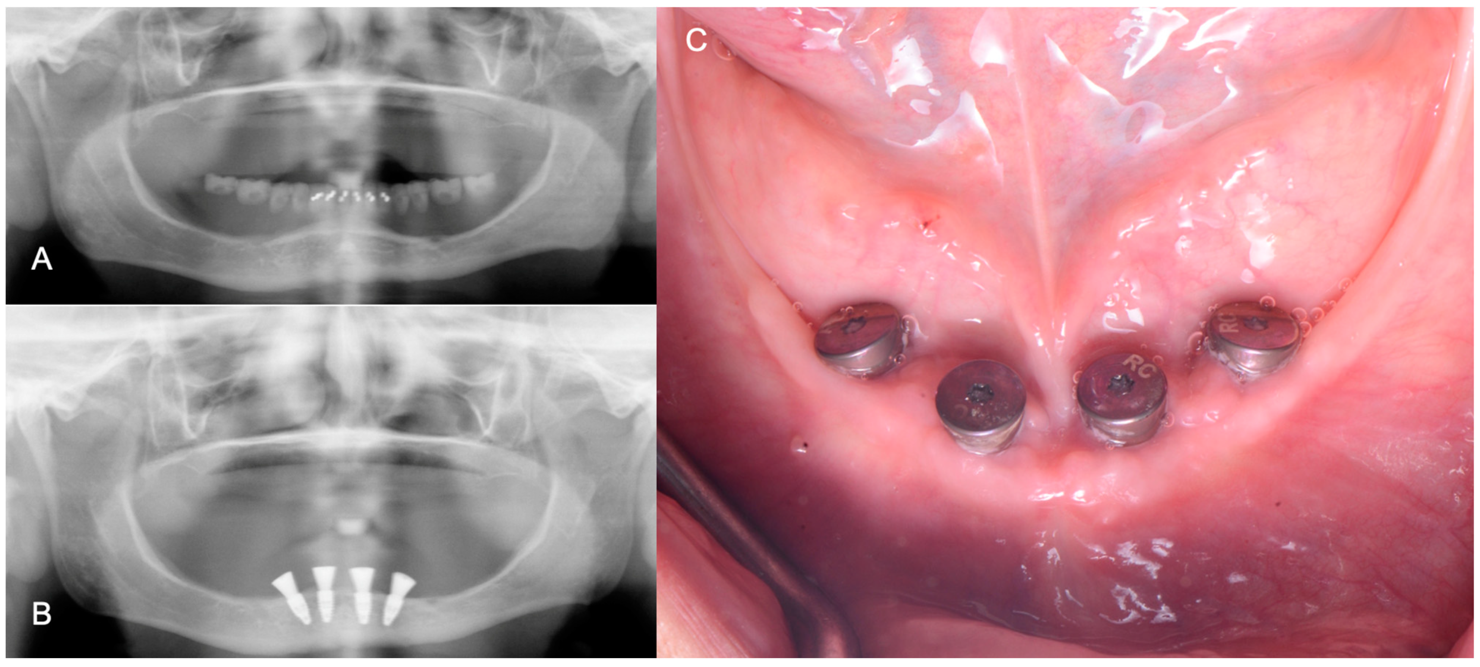Medicina 60 00260 g006