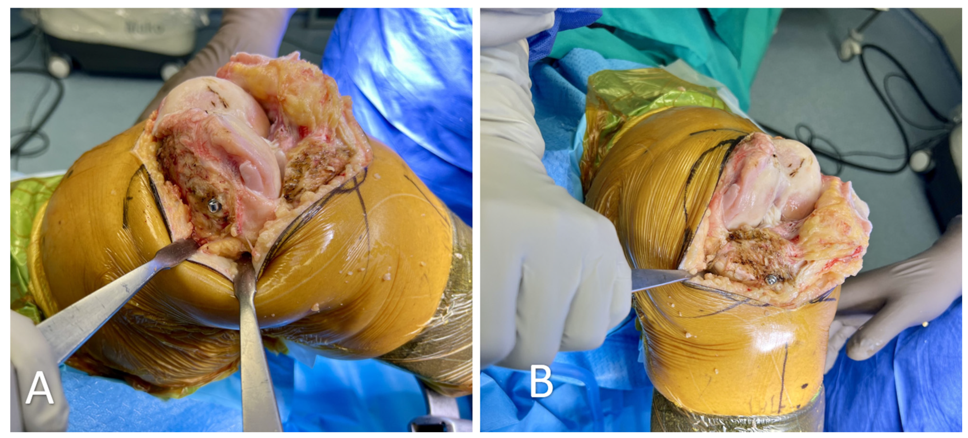 Medicina 60 00262 g002