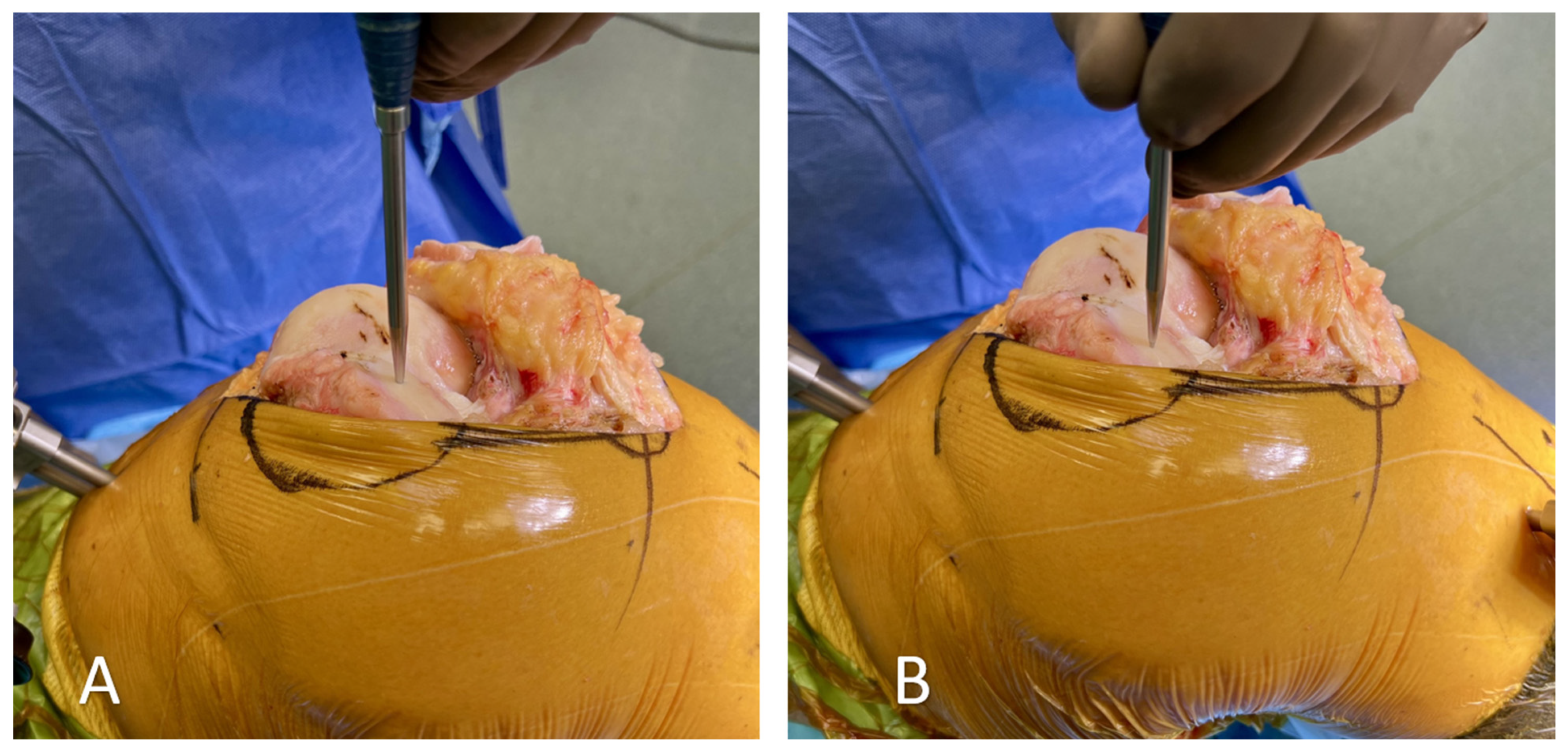 Medicina 60 00262 g003