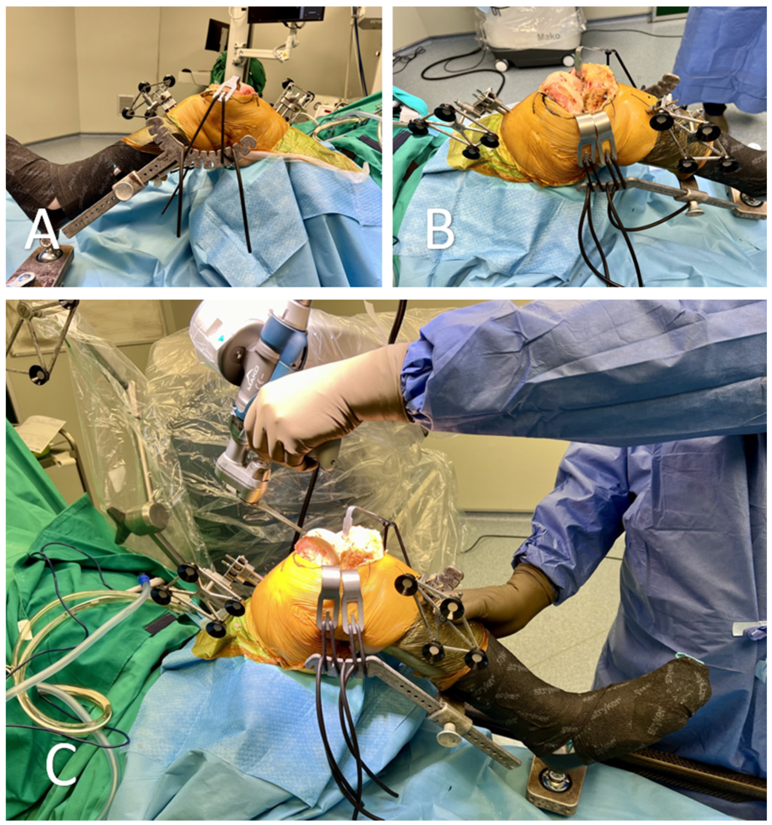 Medicina 60 00262 g004