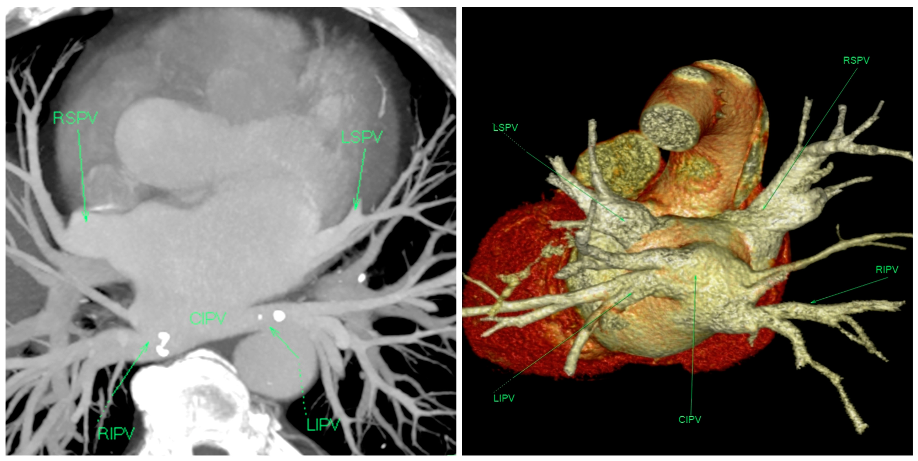 Medicina 60 00264 g002