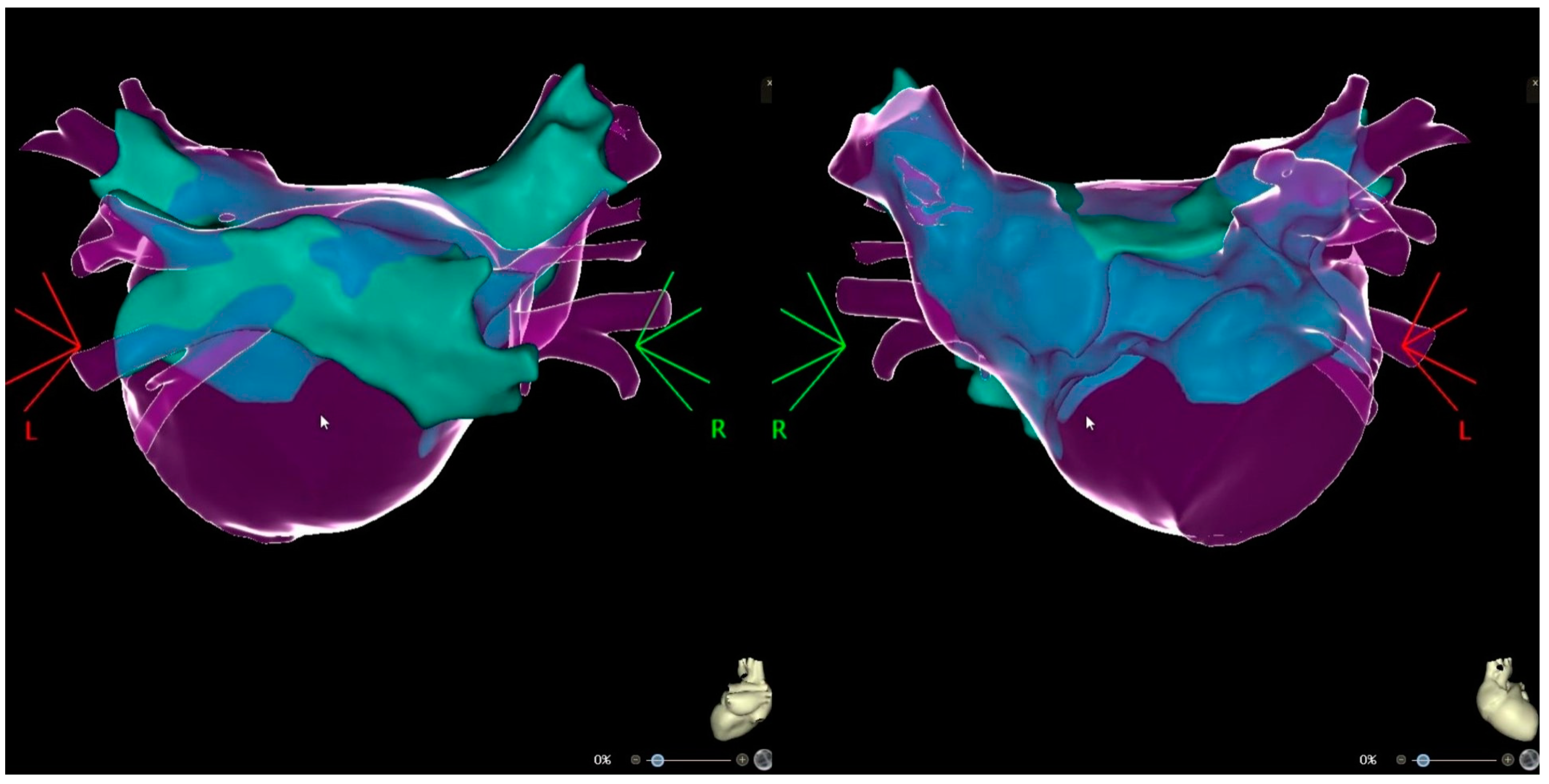 Medicina 60 00264 g003