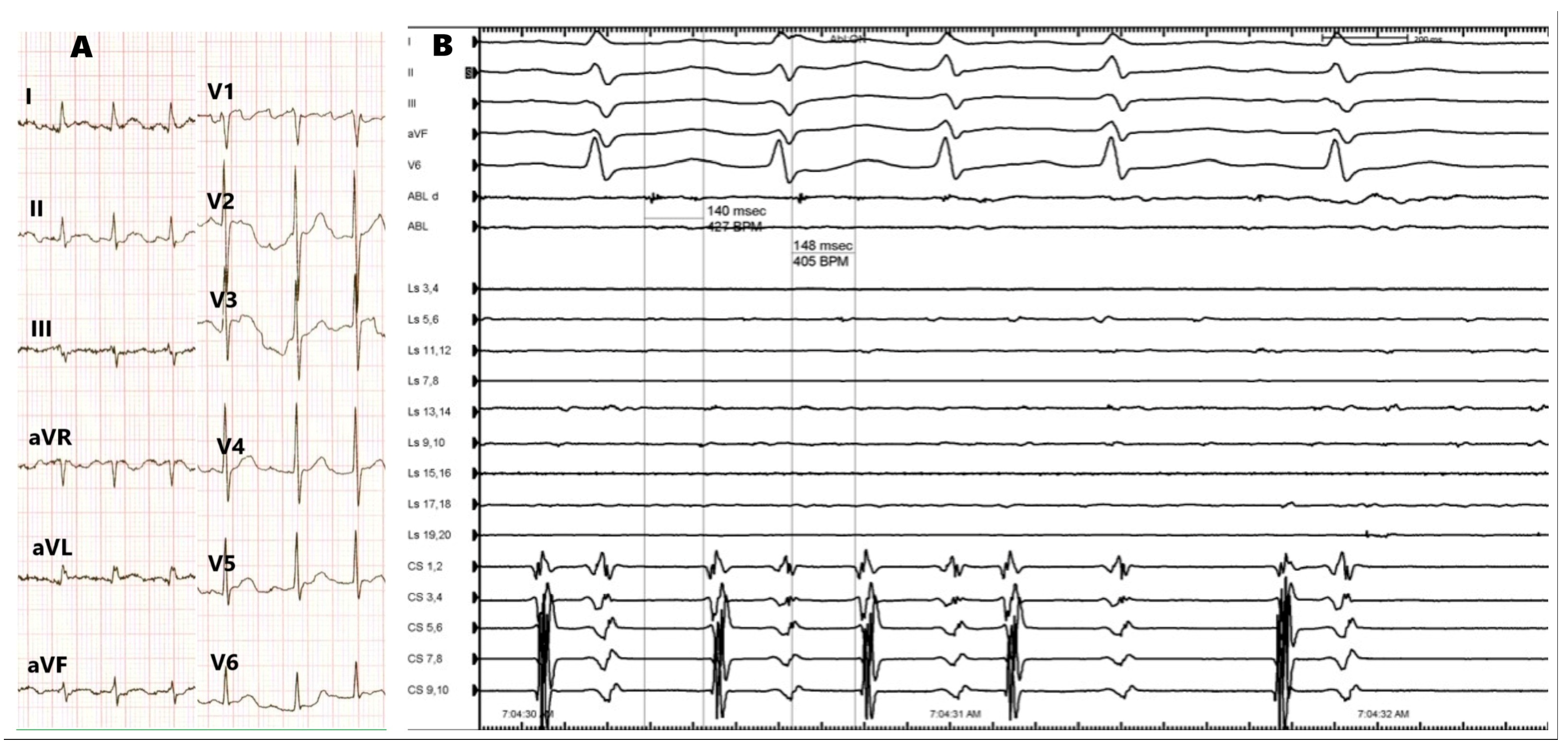 Medicina 60 00264 g004
