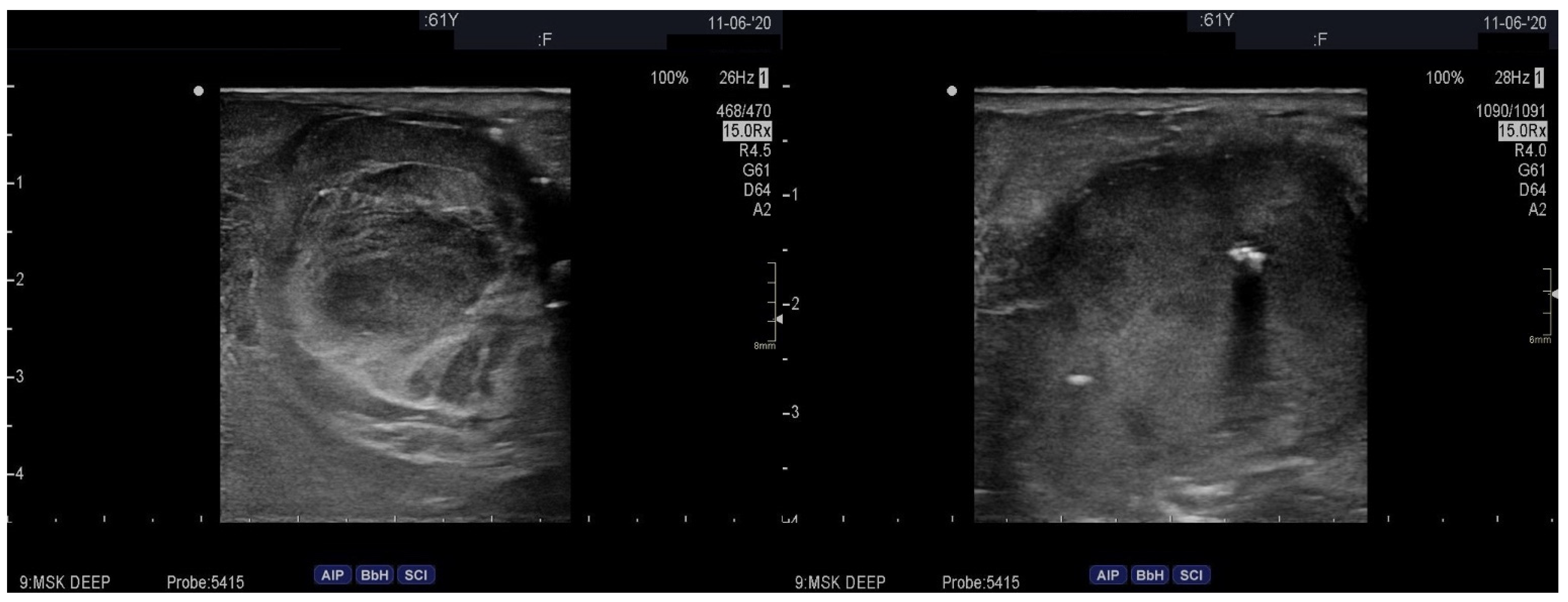 Medicina 60 00290 g001