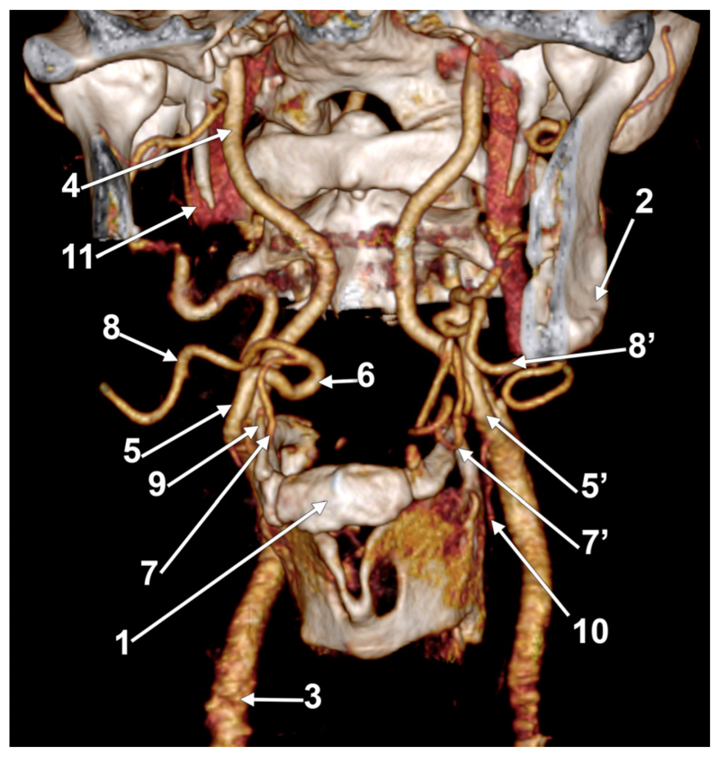 Medicina 60 00291 g004