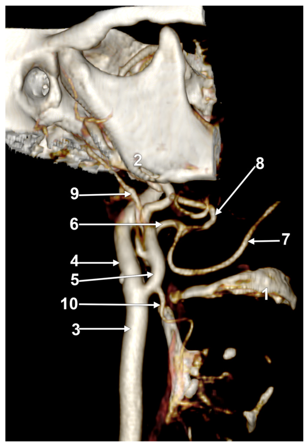 Medicina 60 00291 g006