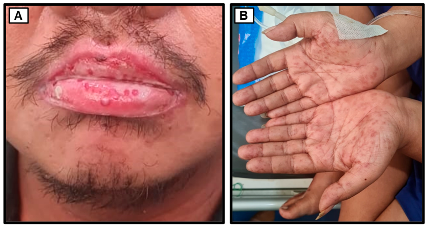 Medicina 60 00298 g004