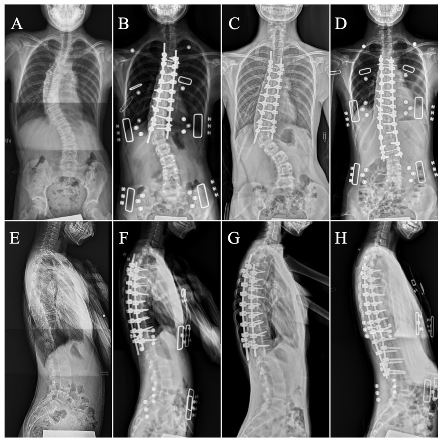 Medicina 60 00300 g007