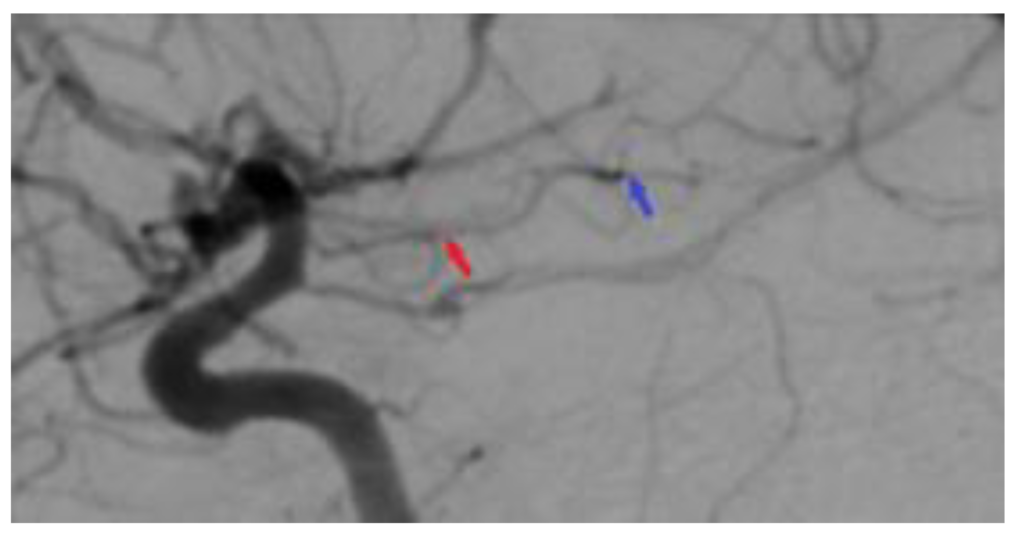 Medicina 60 00302 g006