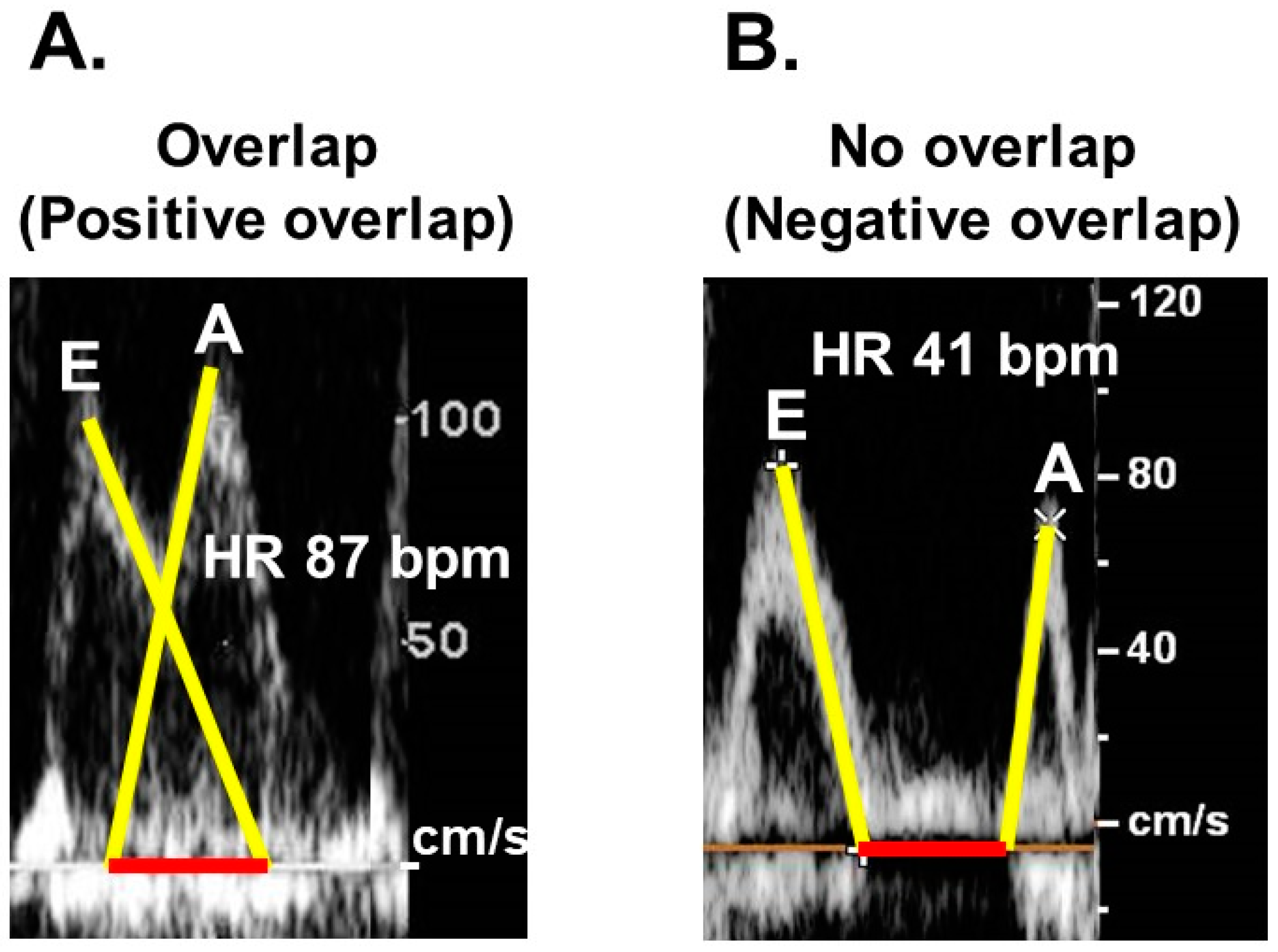 Medicina 60 00303 g005