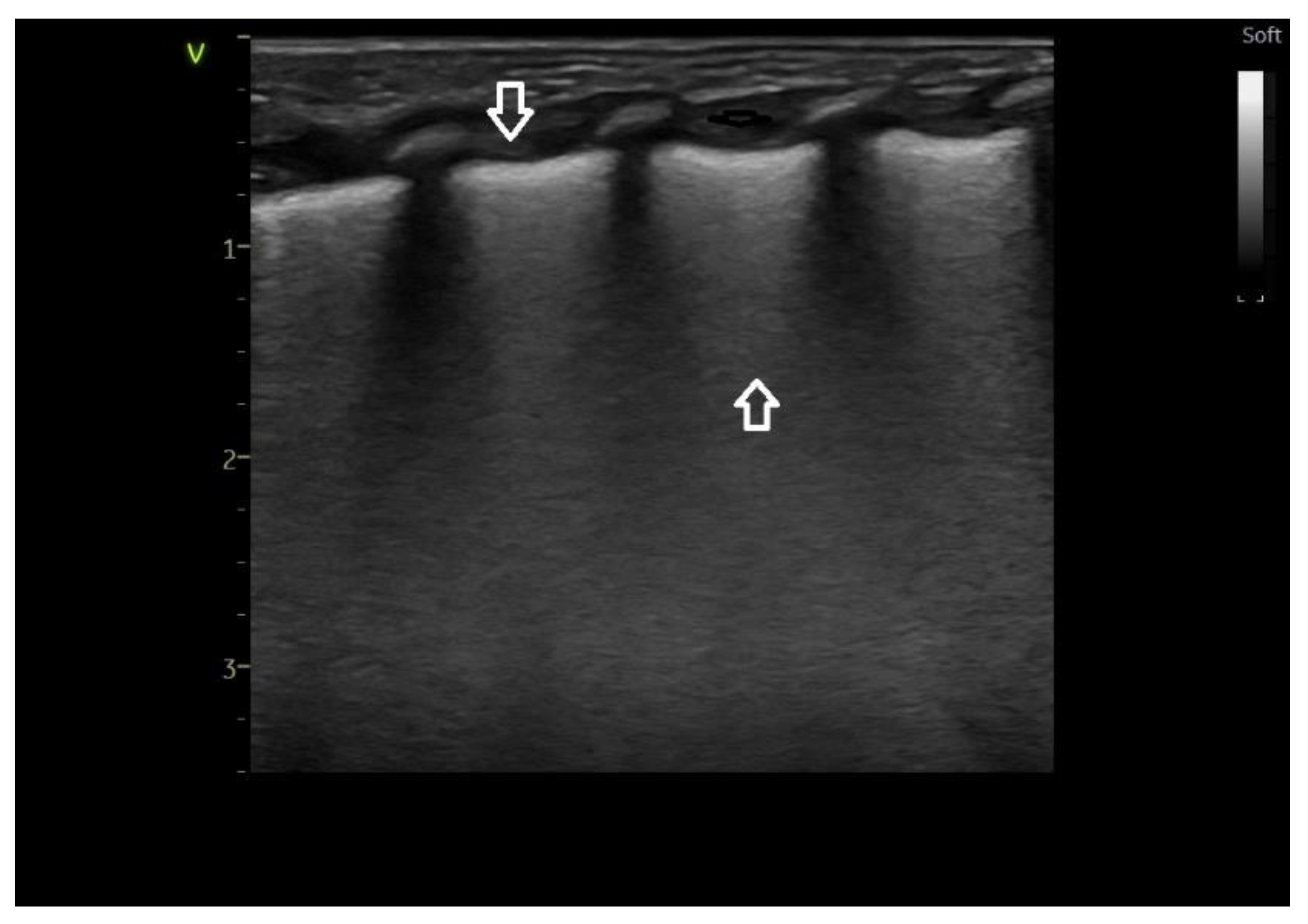Medicina 60 00308 g002