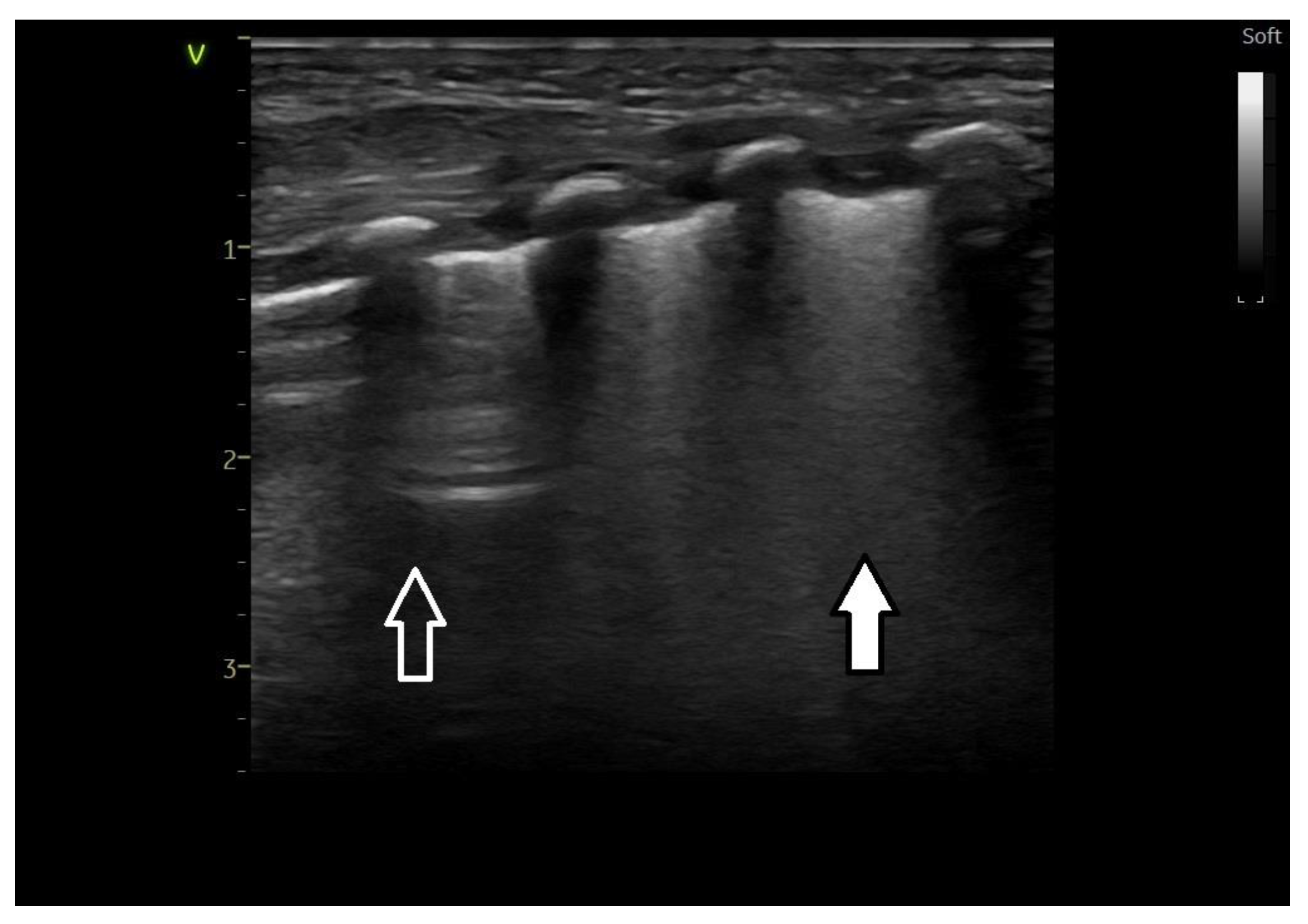 Medicina 60 00308 g003