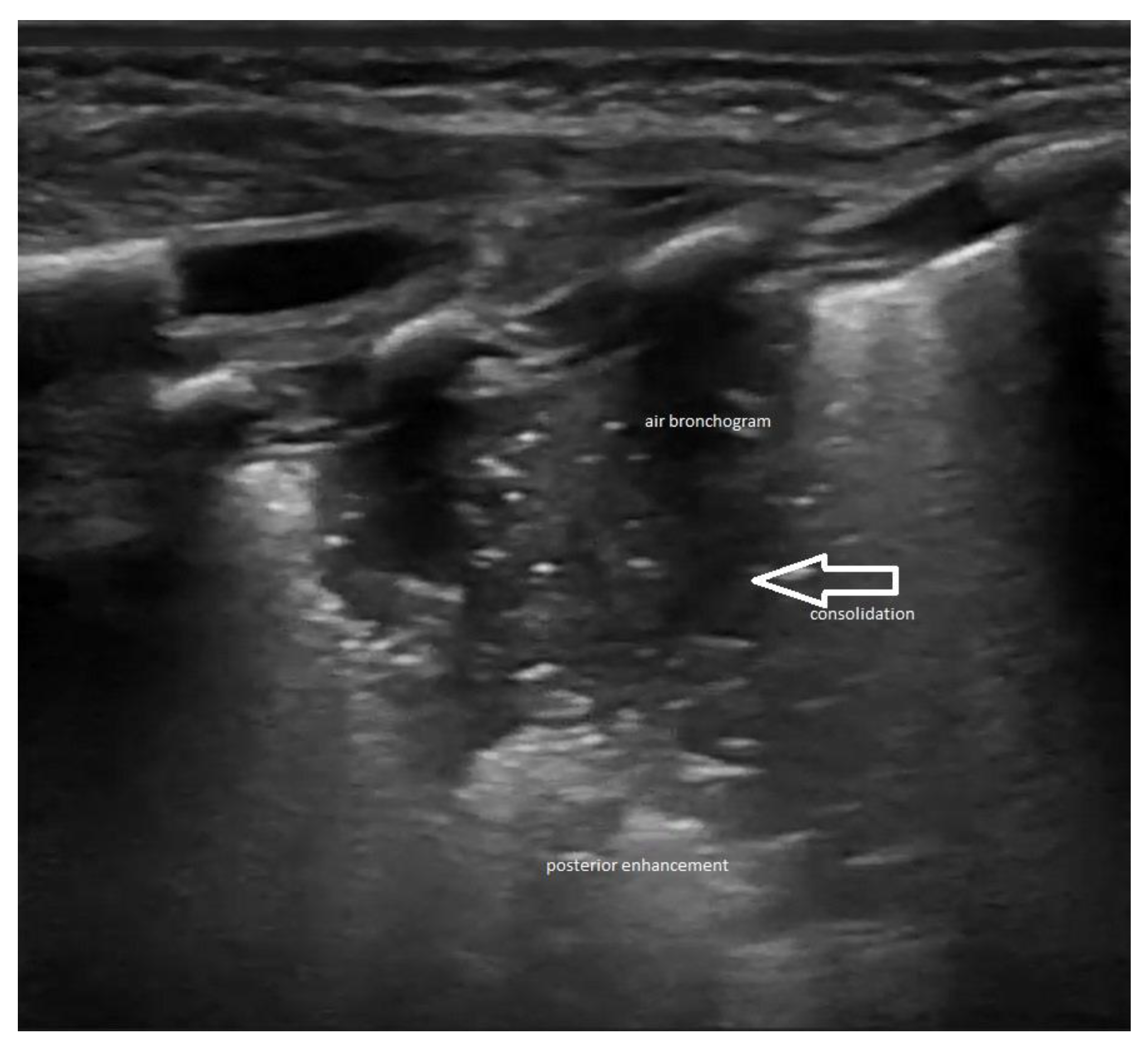 Medicina 60 00308 g004