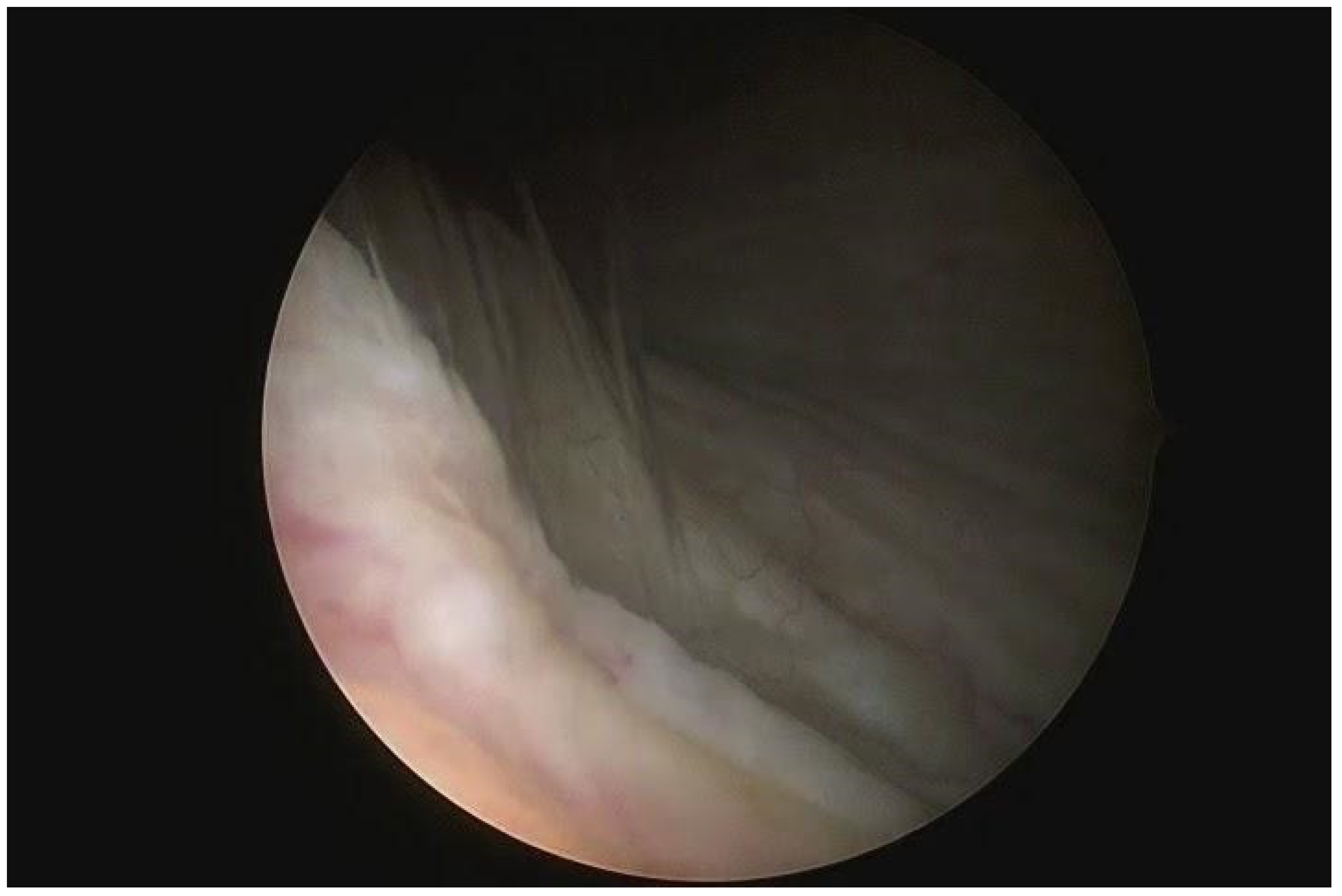 Medicina 60 00320 g002