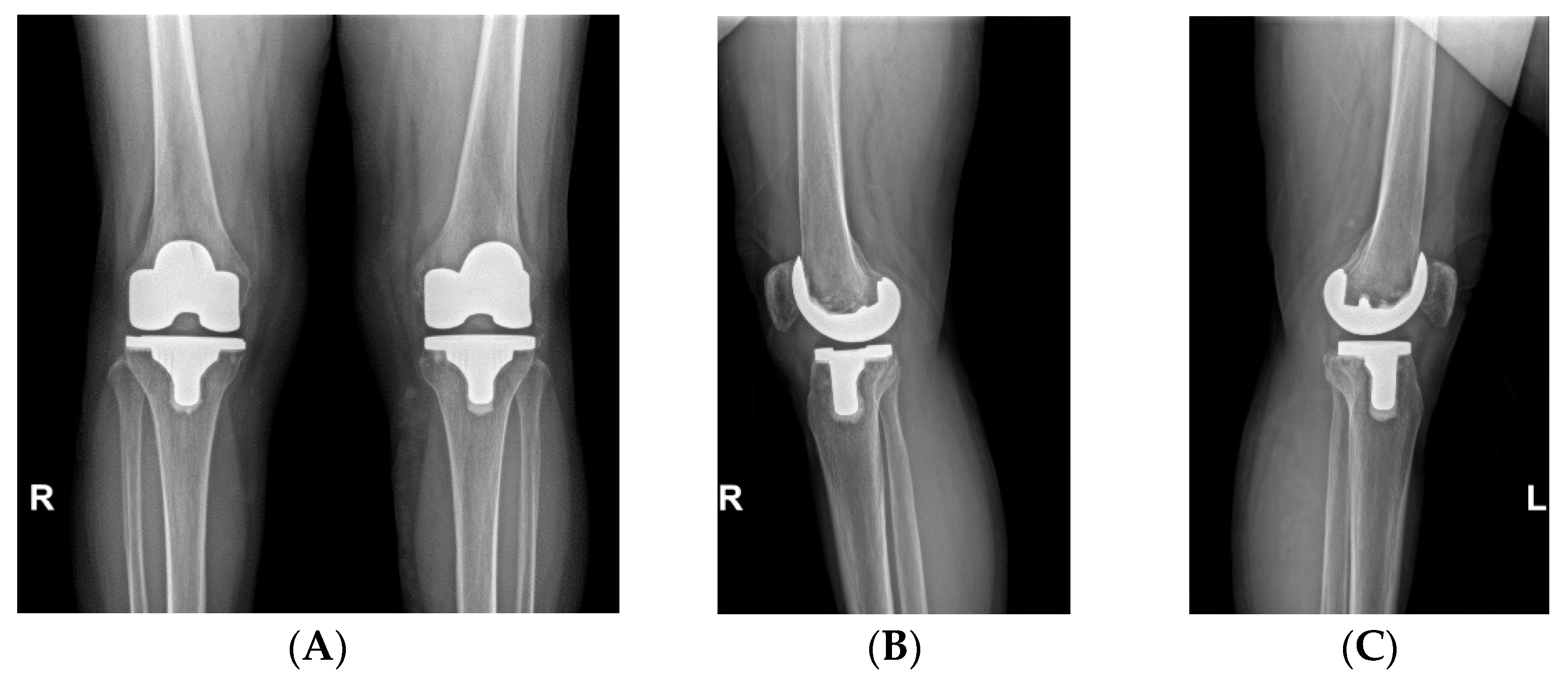 Medicina 60 00322 g002