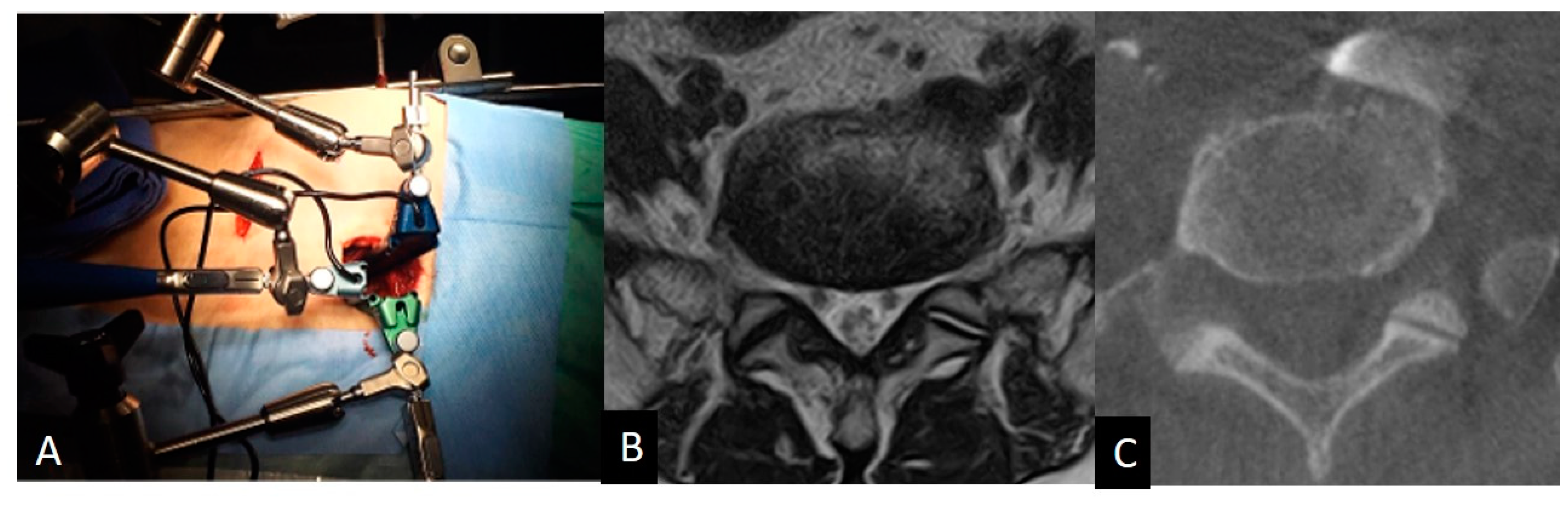Medicina 60 00326 g001