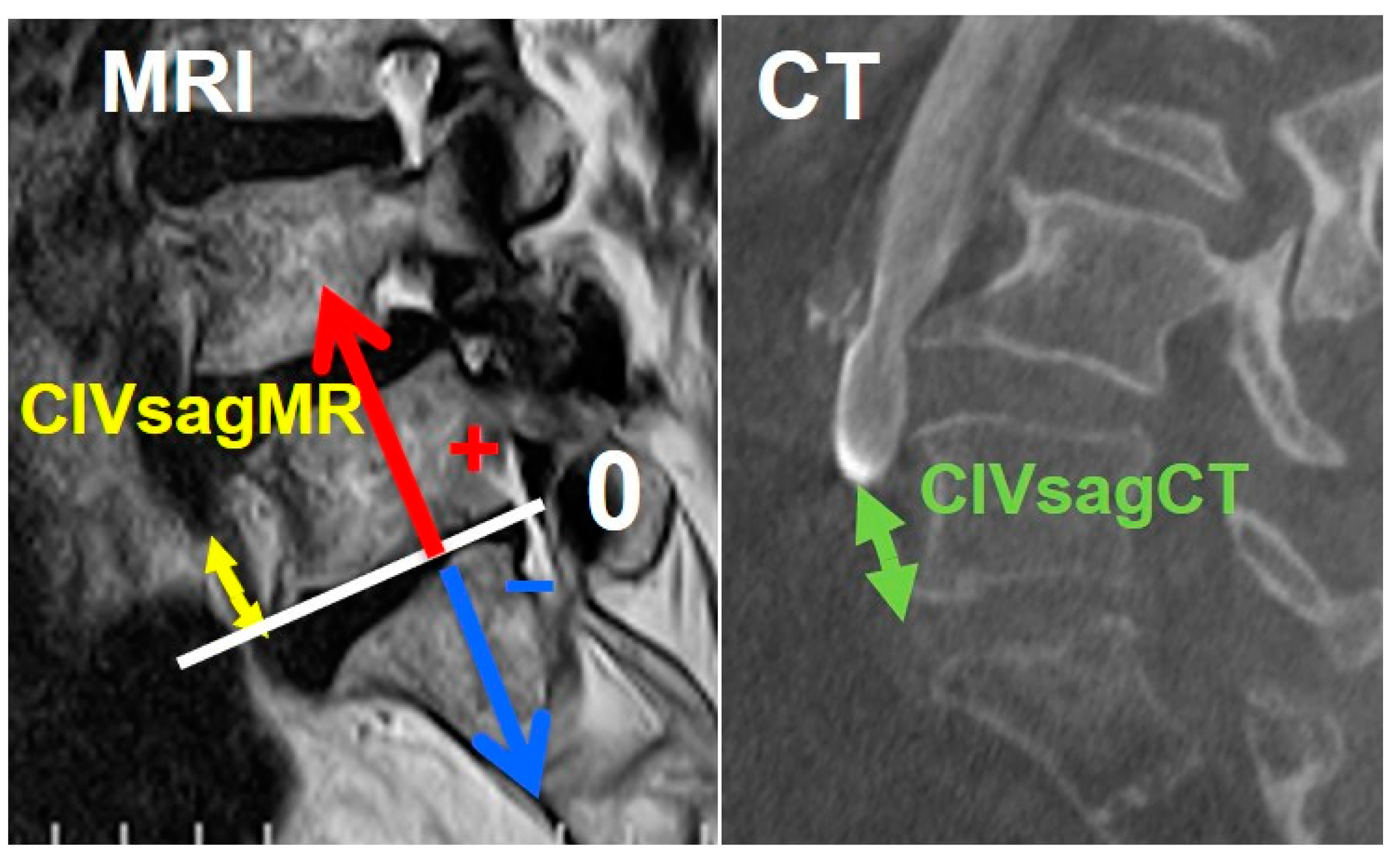 Medicina 60 00326 g004