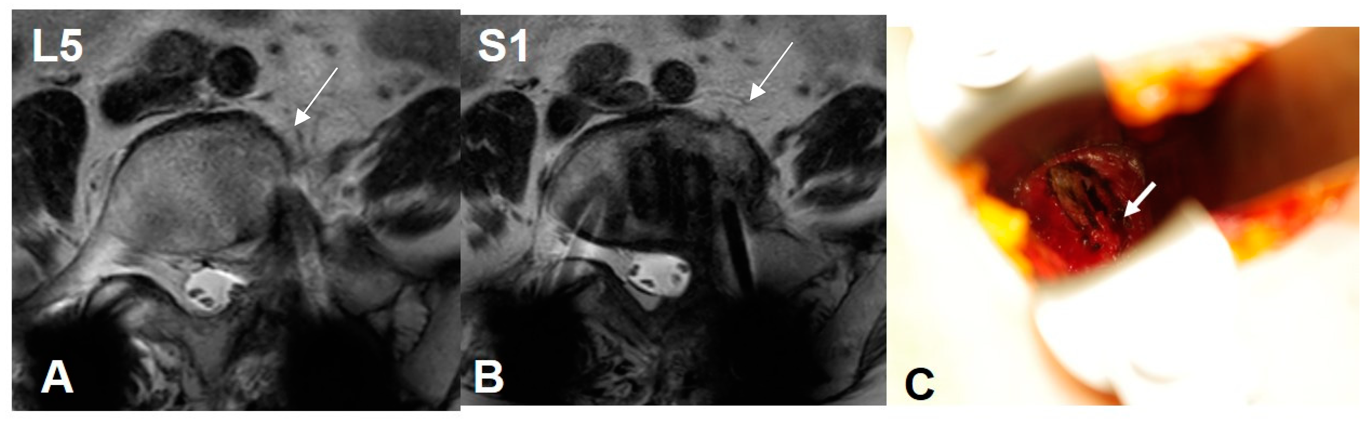 Medicina 60 00326 g007