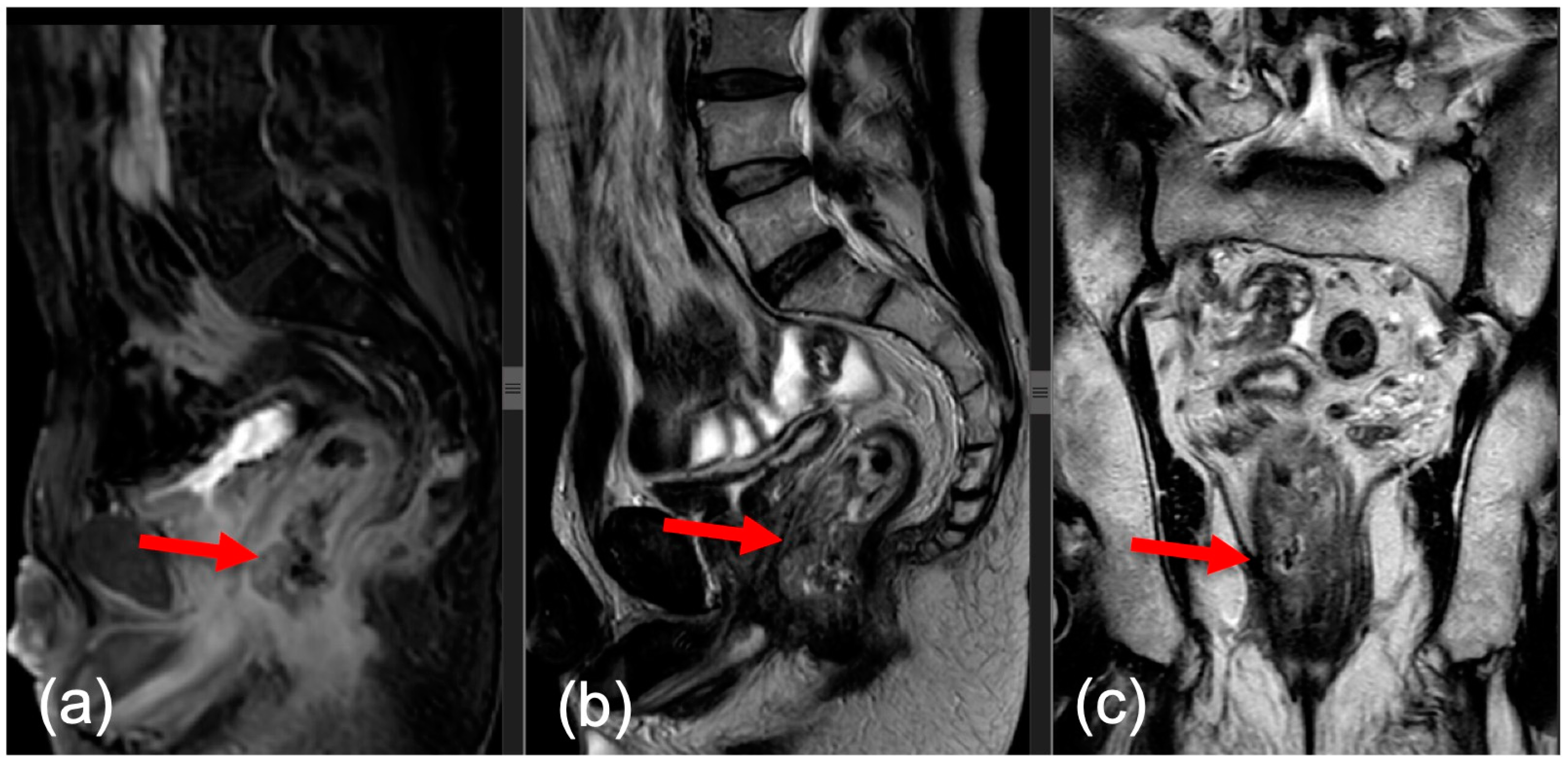 Medicina 60 00330 g001