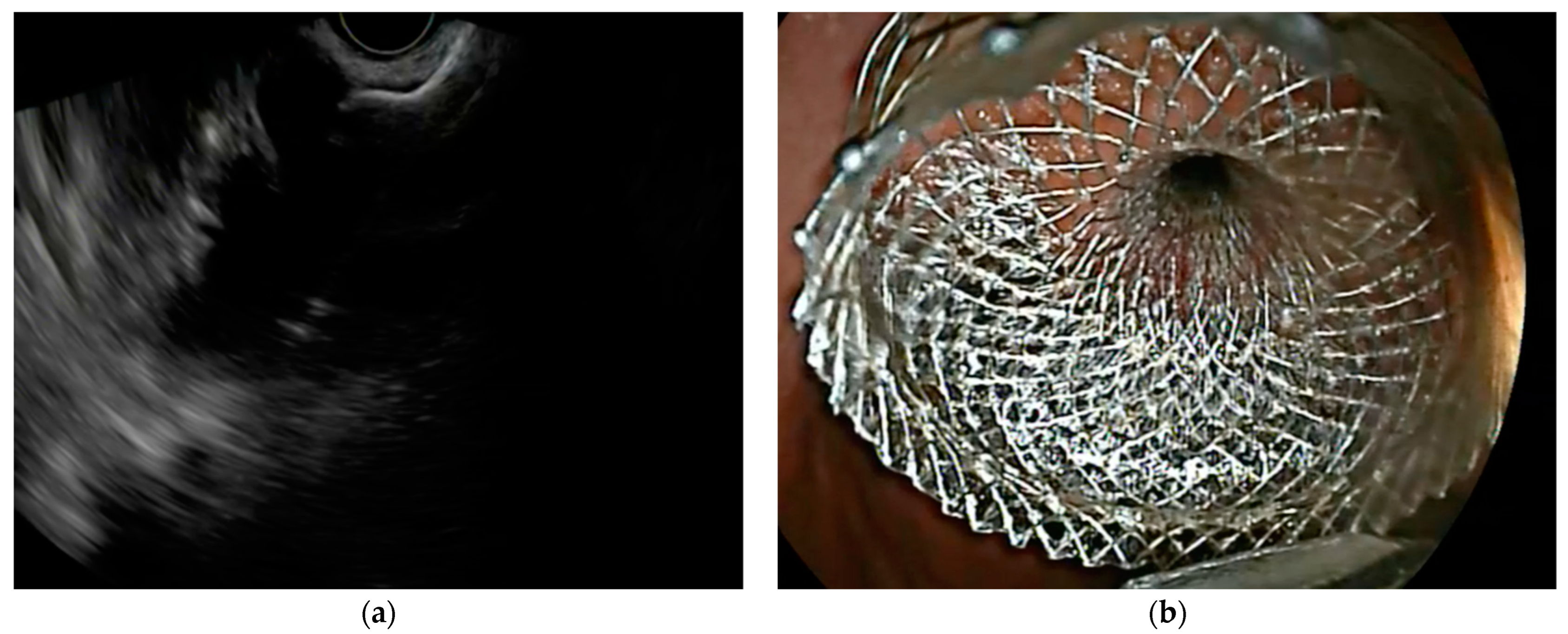 Medicina 60 00333 g003