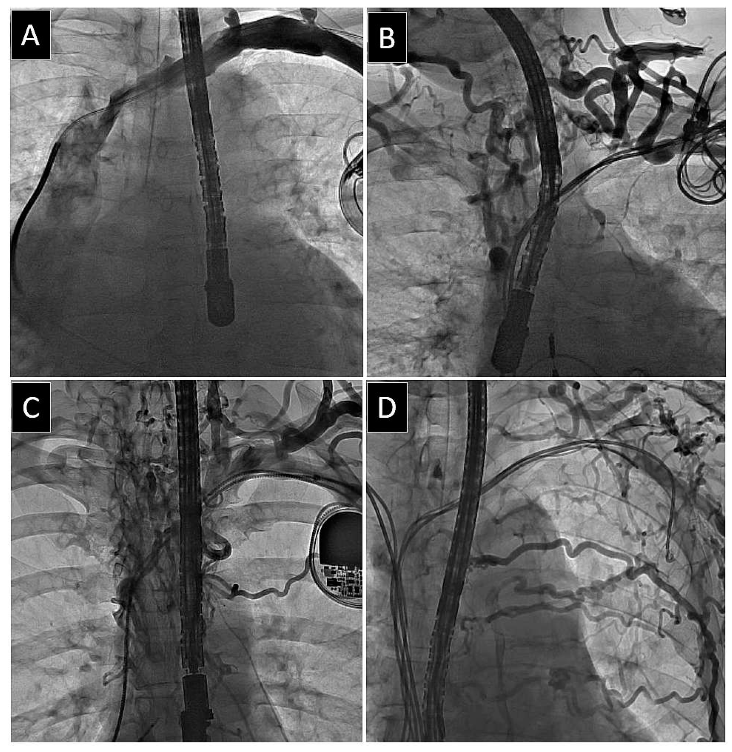 Medicina 60 00336 g002