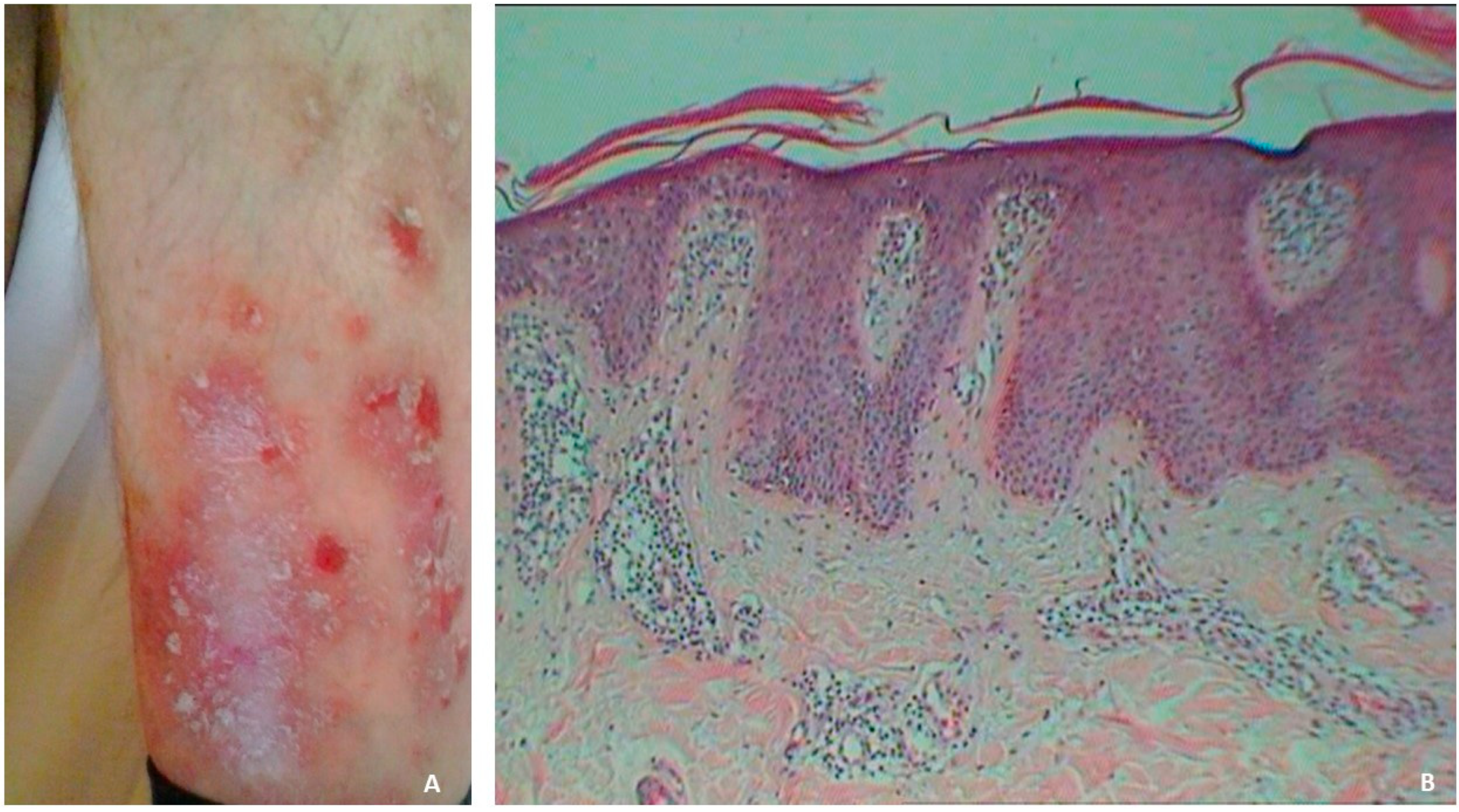 Medicina 60 00337 g001
