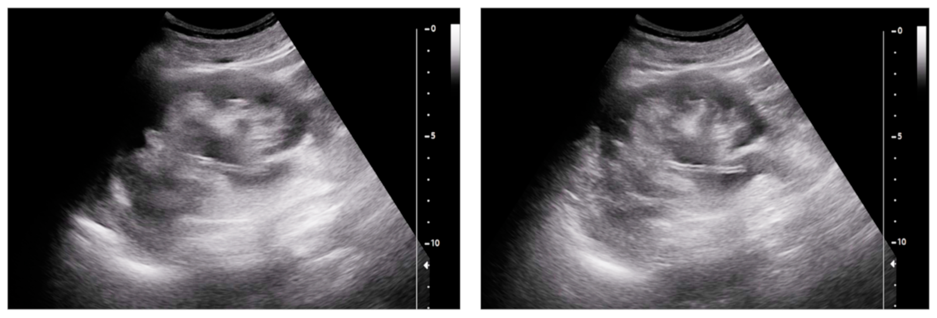 Medicina 60 00338 g001