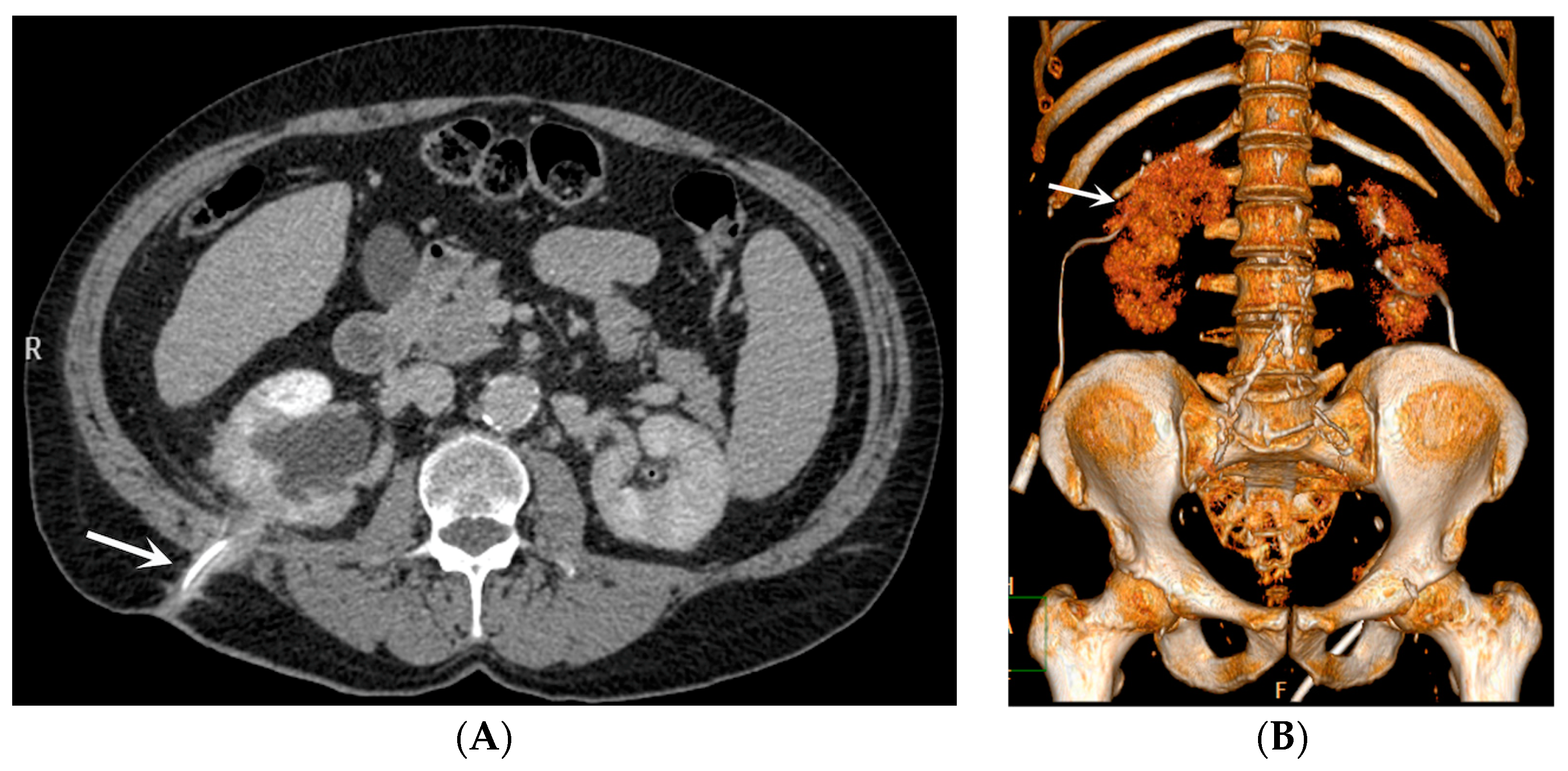 Medicina 60 00338 g002