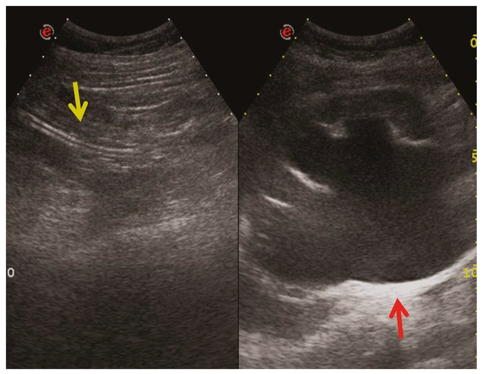 Medicina 60 00338 g003