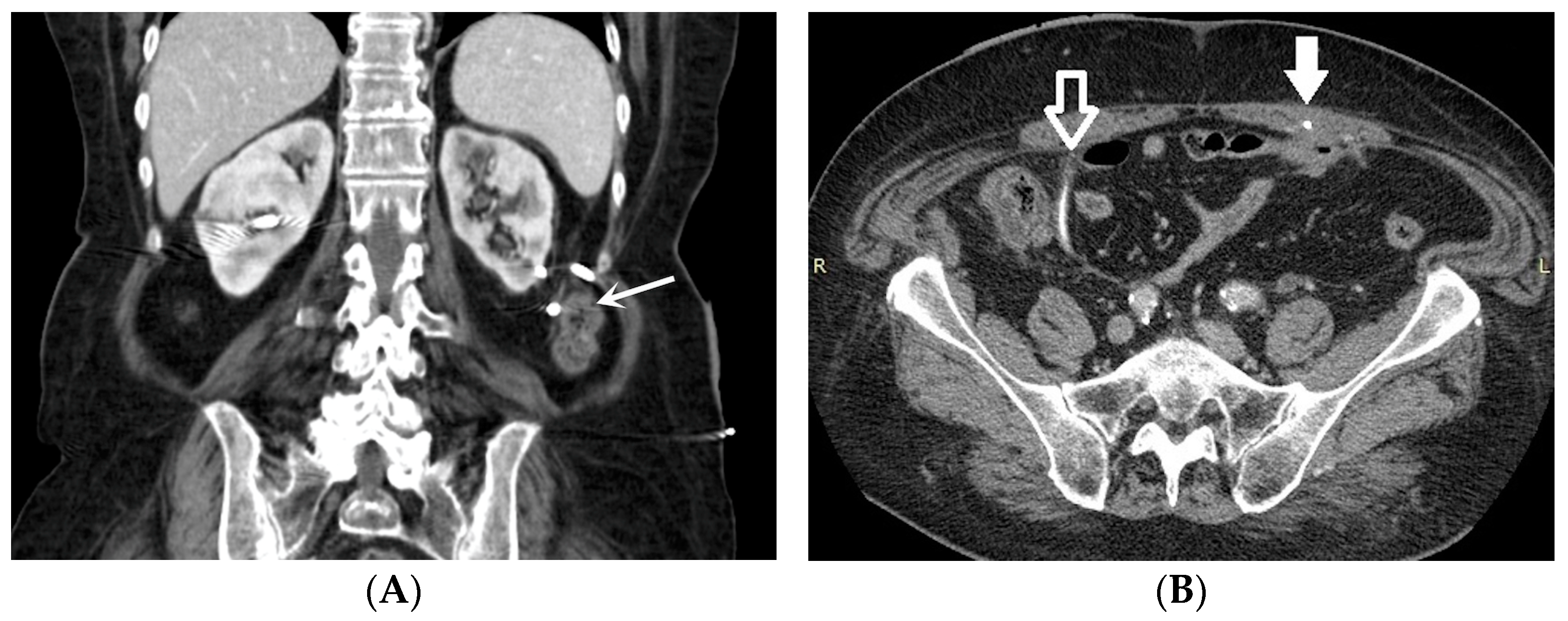 Medicina 60 00338 g004