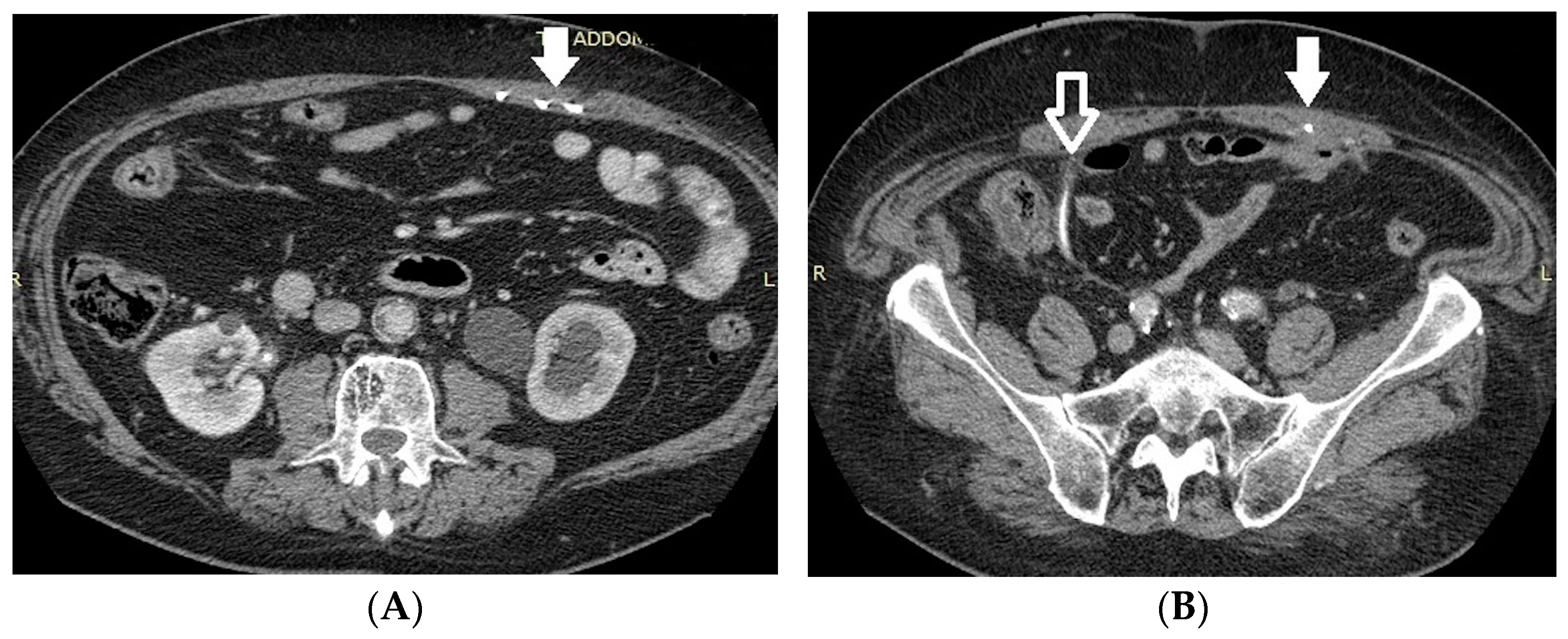 Medicina 60 00338 g005