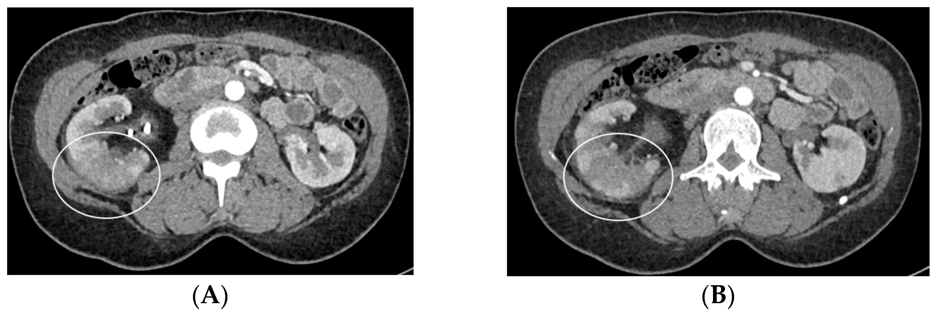 Medicina 60 00338 g008a