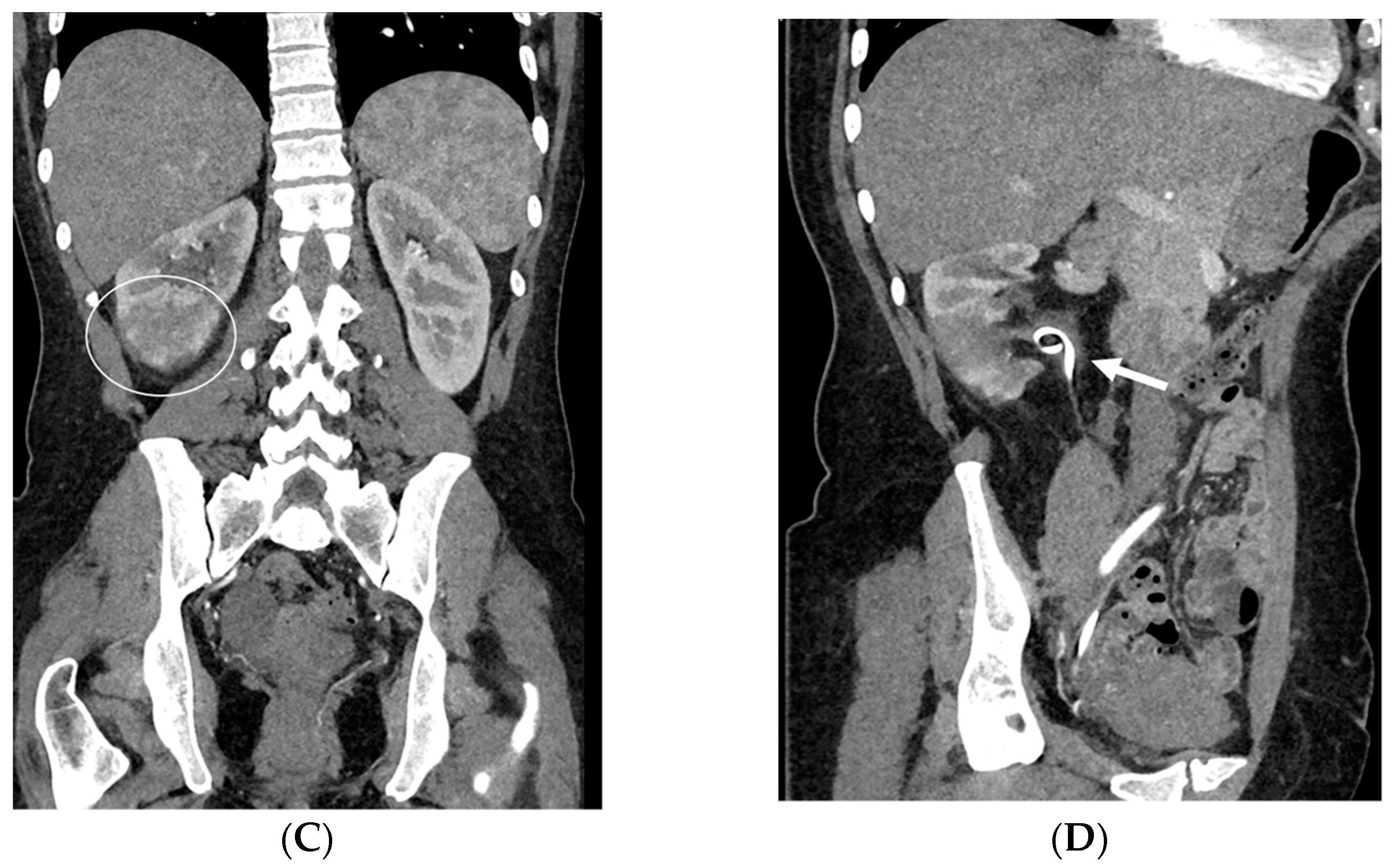 Medicina 60 00338 g008b