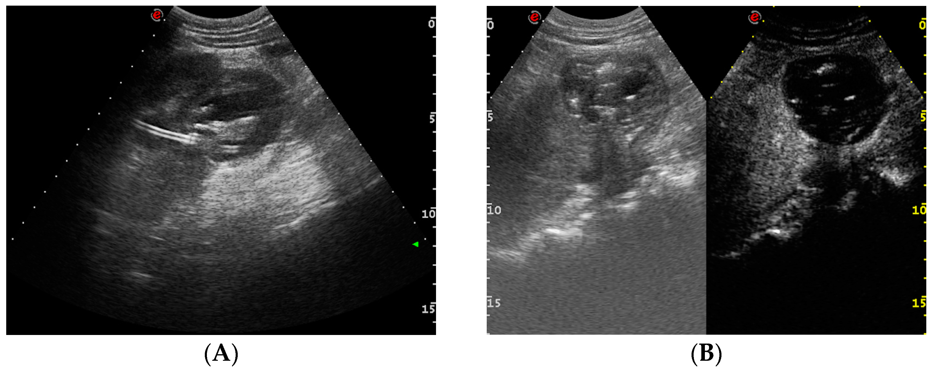 Medicina 60 00338 g011