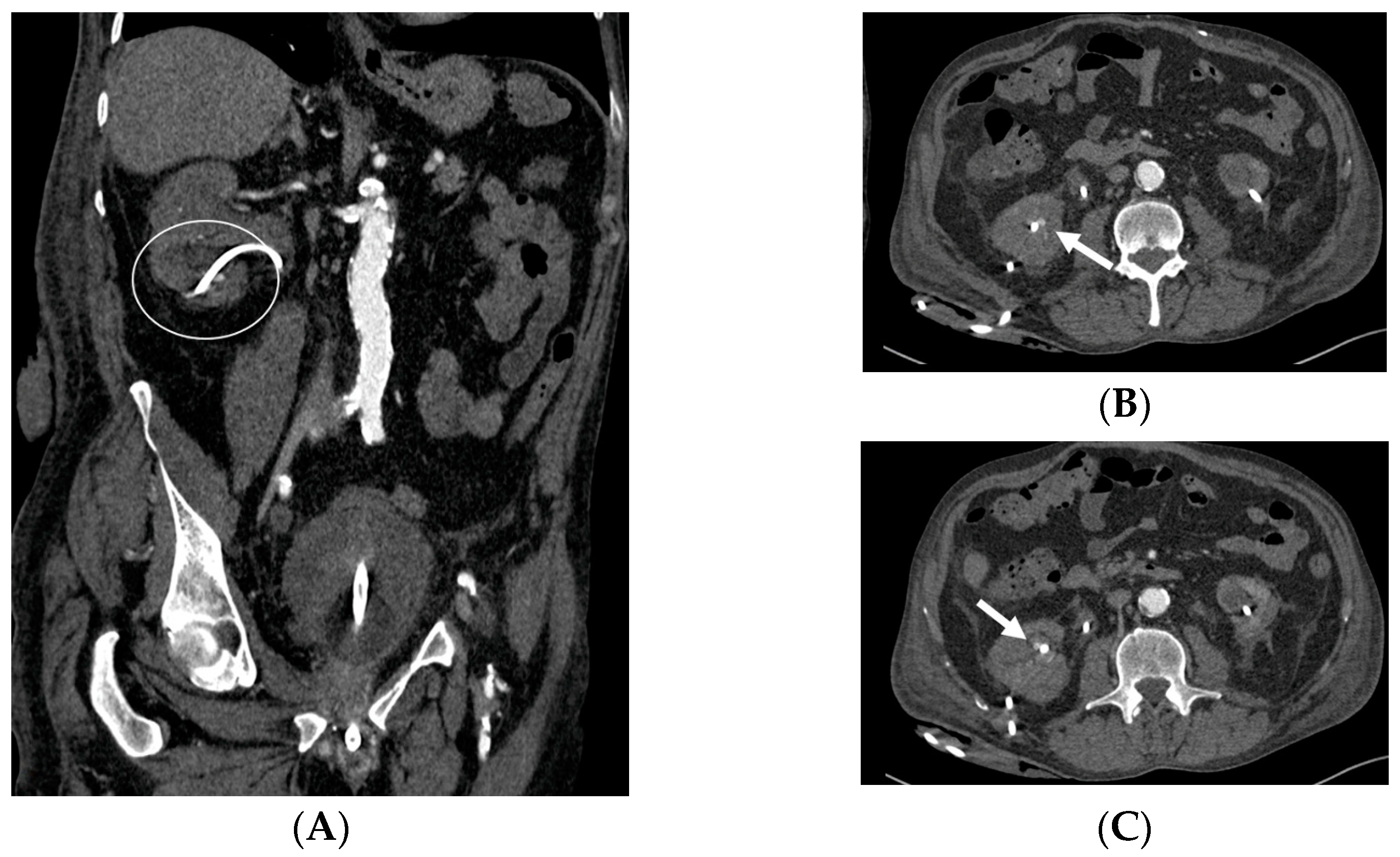 Medicina 60 00338 g013