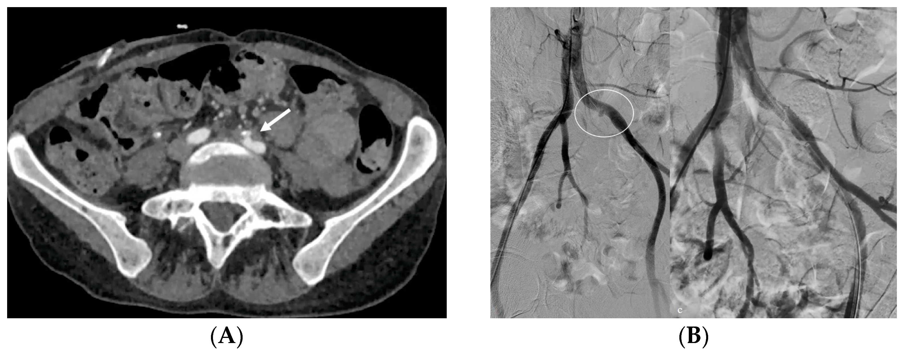 Medicina 60 00338 g014