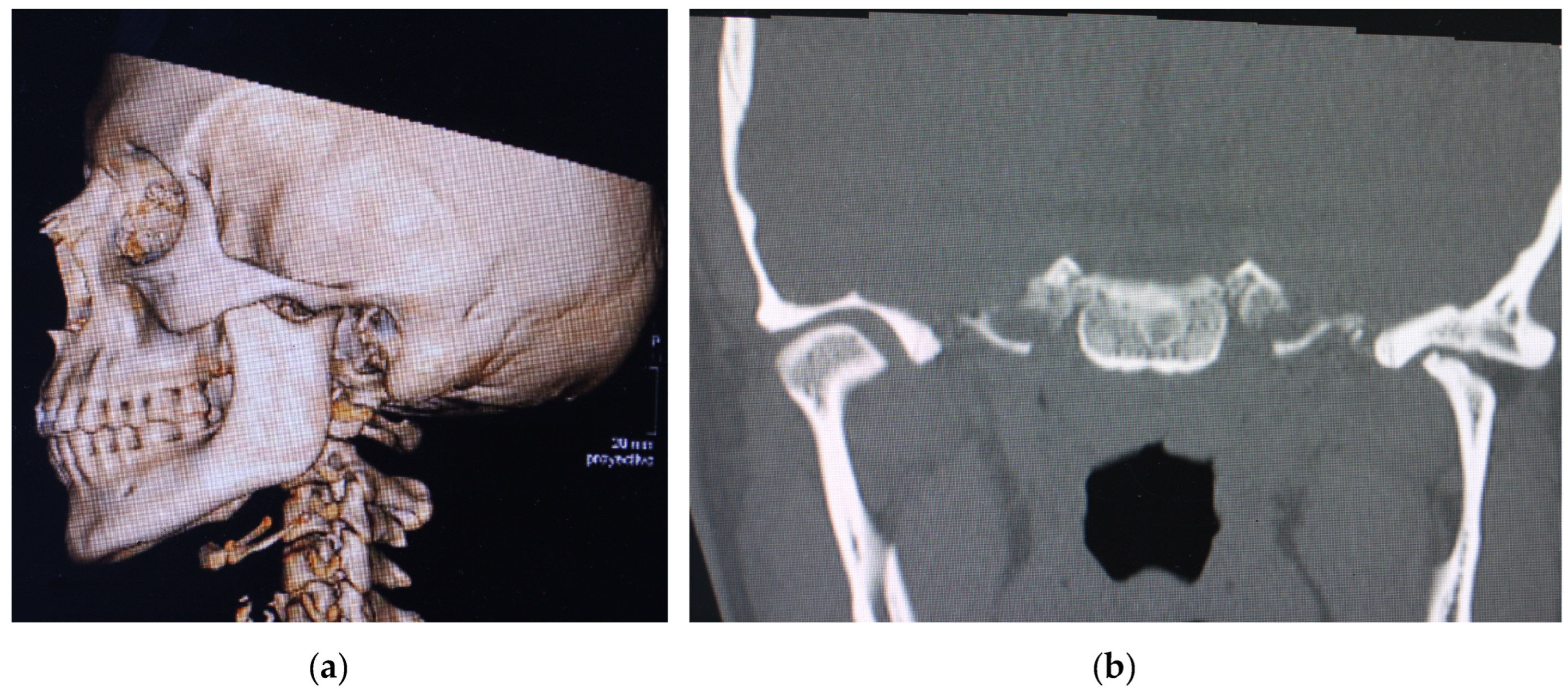 臨床解剖学に基づいたComprehensive Dental Surgery Assessment of a New Medical Device (PirifixTM) for