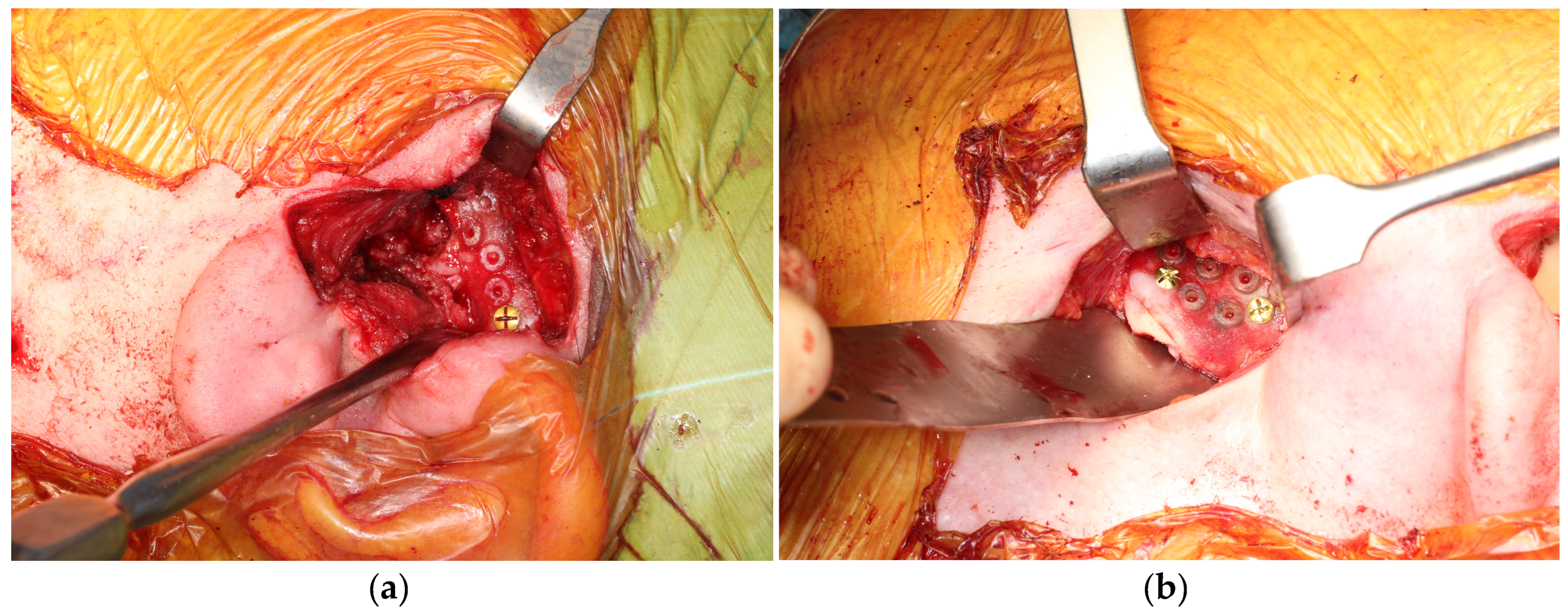 Medicina 60 00339 g006