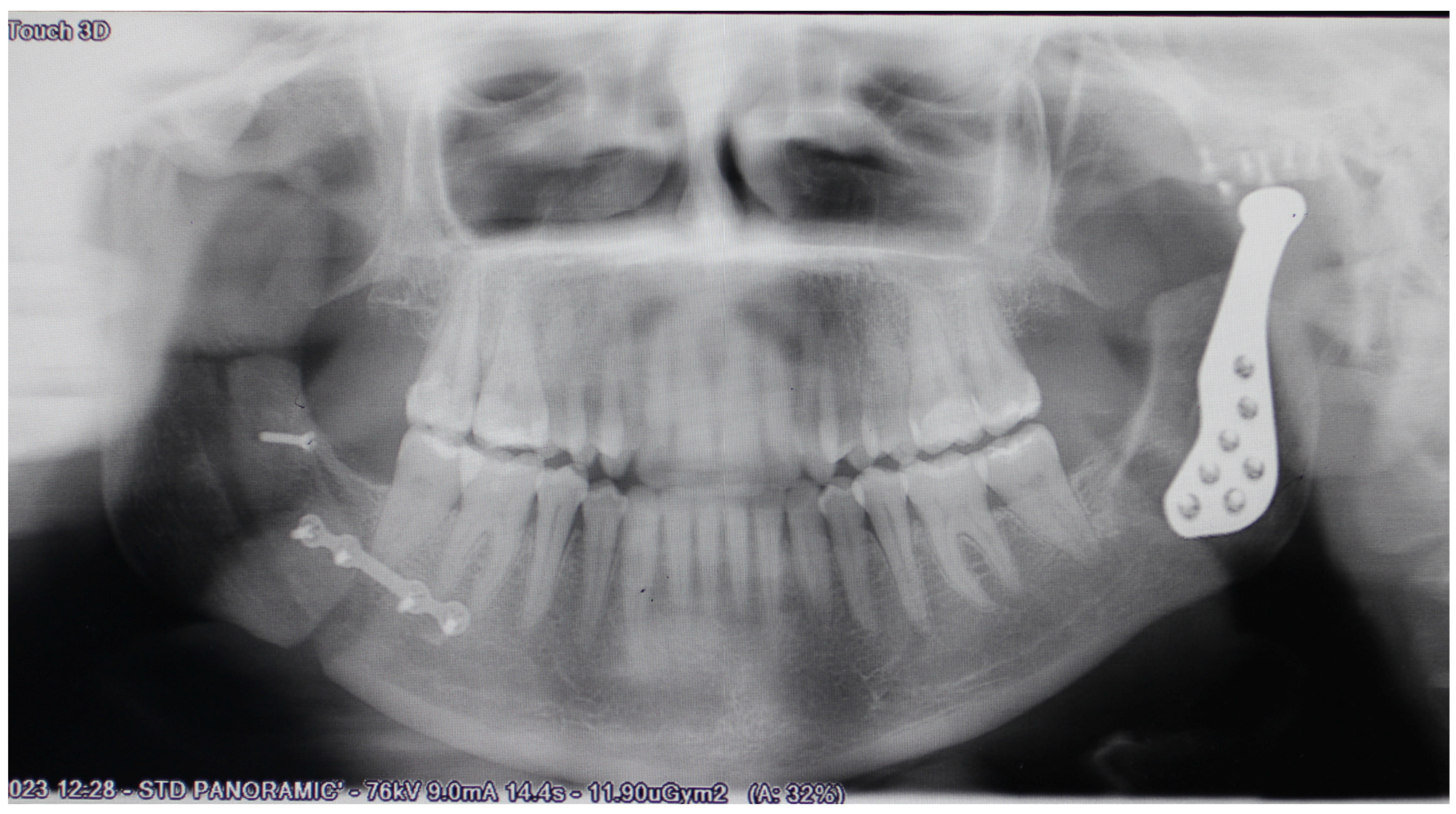 Medicina 60 00339 g008