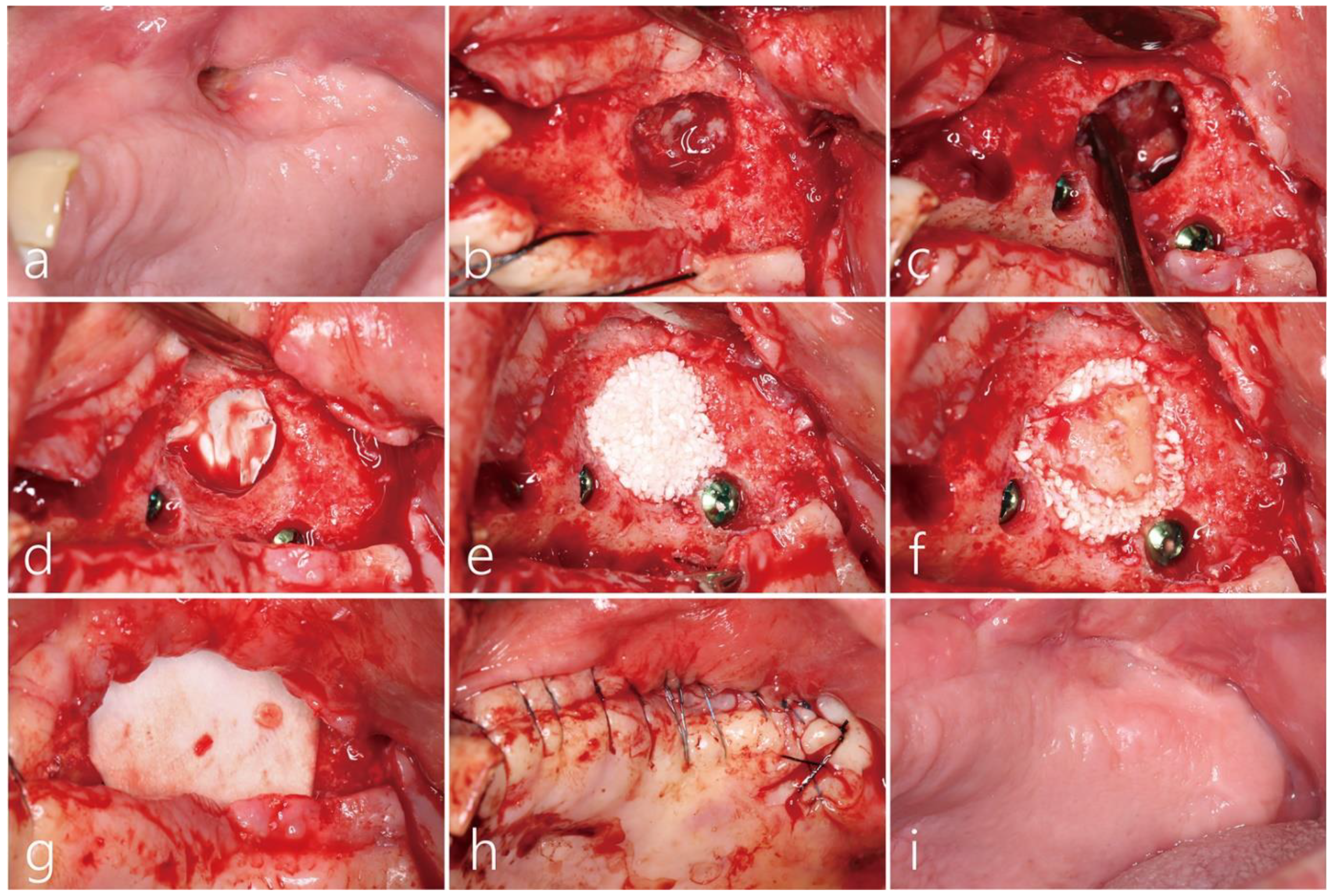 Medicina 60 00343 g002