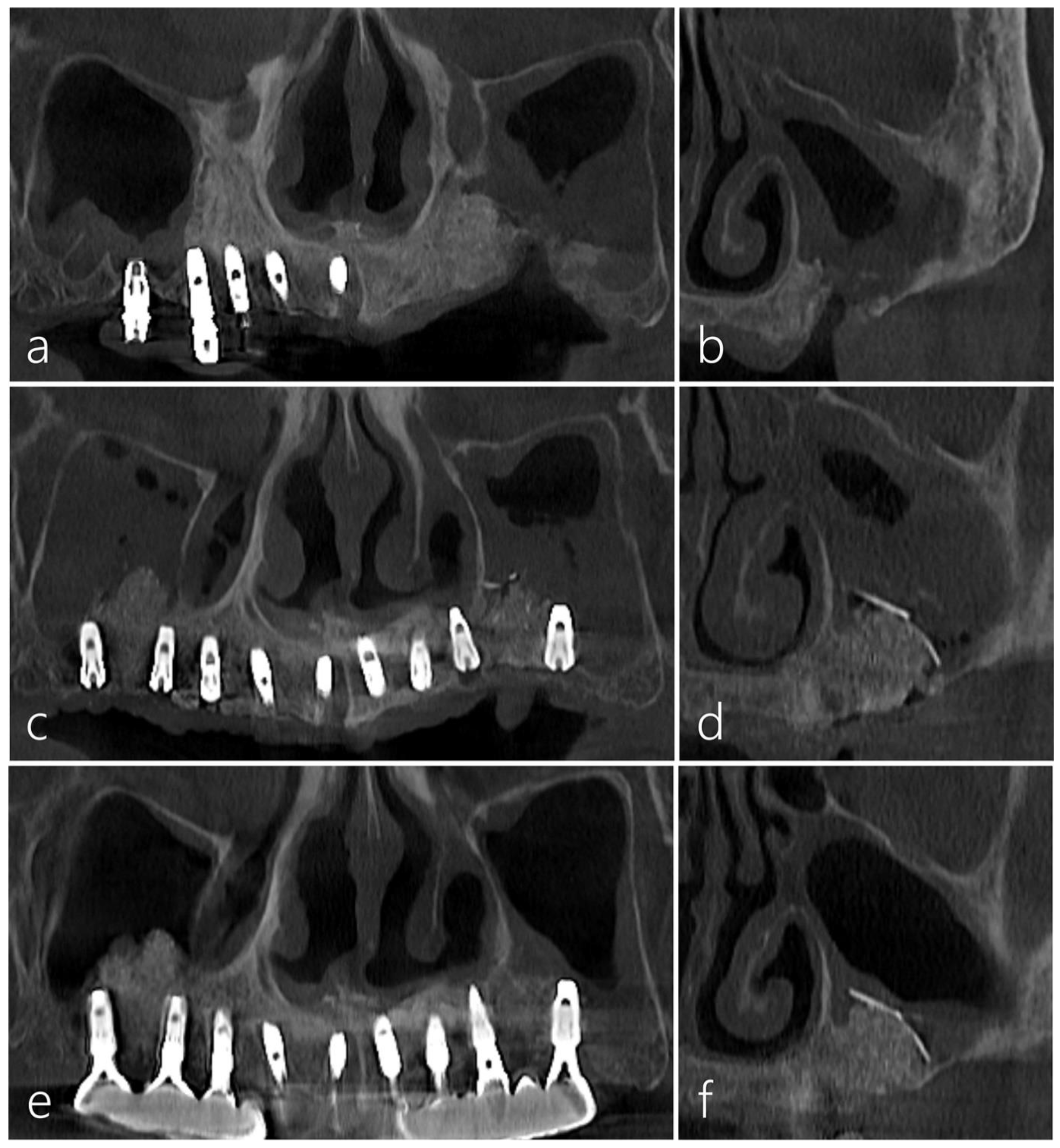 Medicina 60 00343 g003