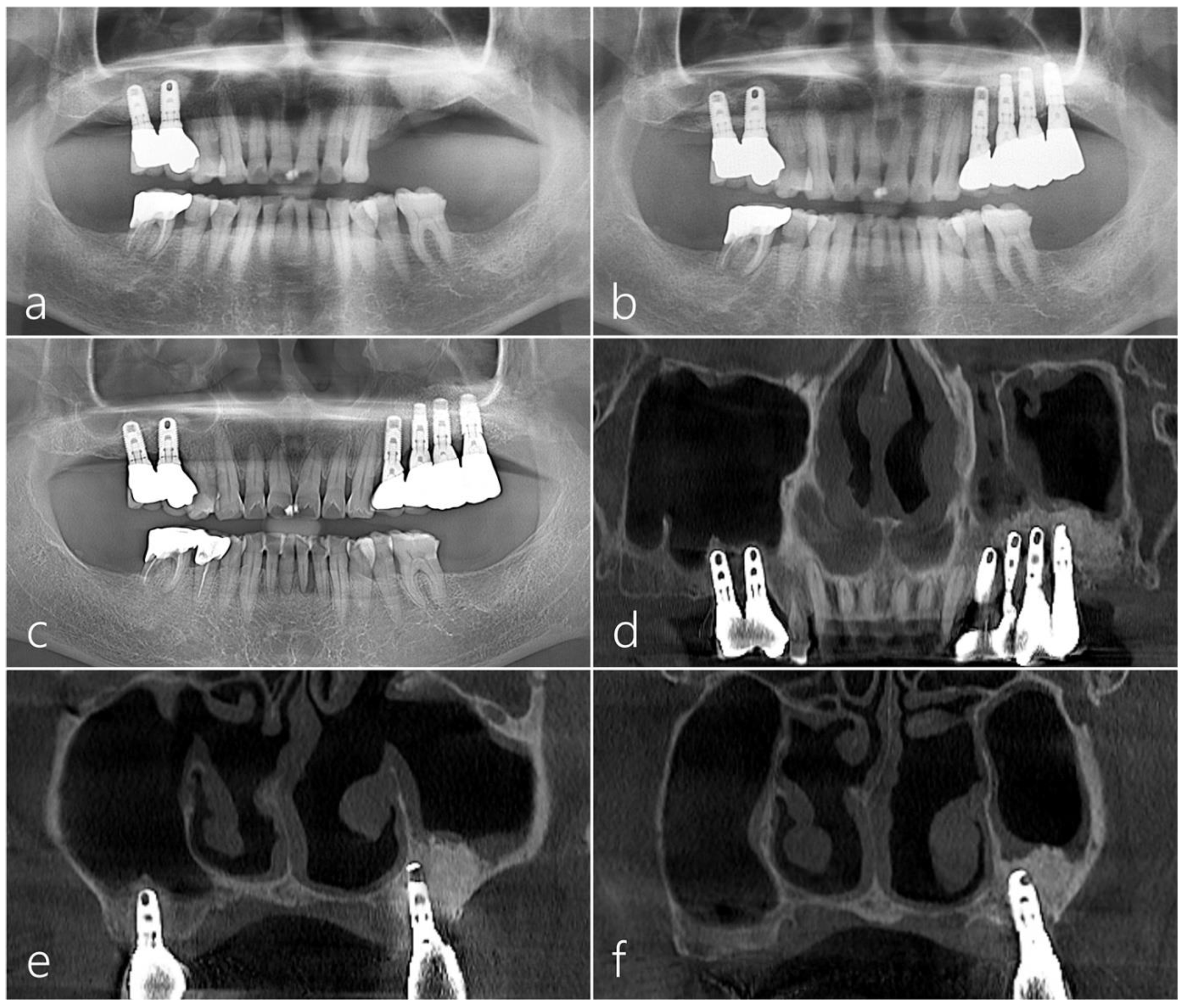 Medicina 60 00343 g006
