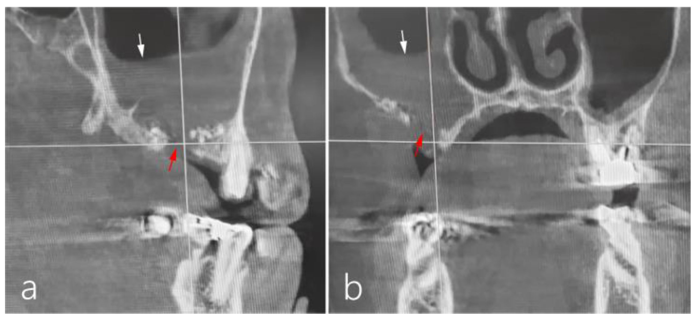 Medicina 60 00343 g007