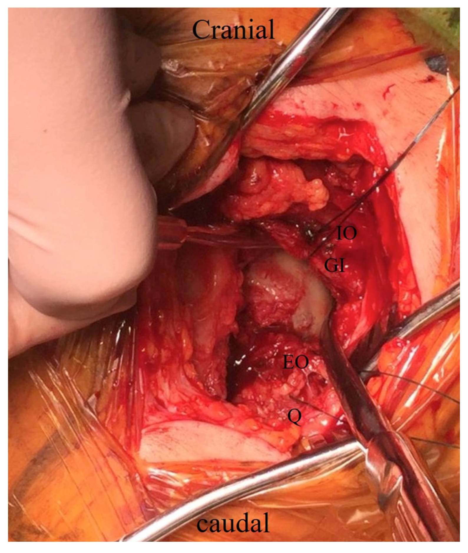 Medicina 60 00356 g002