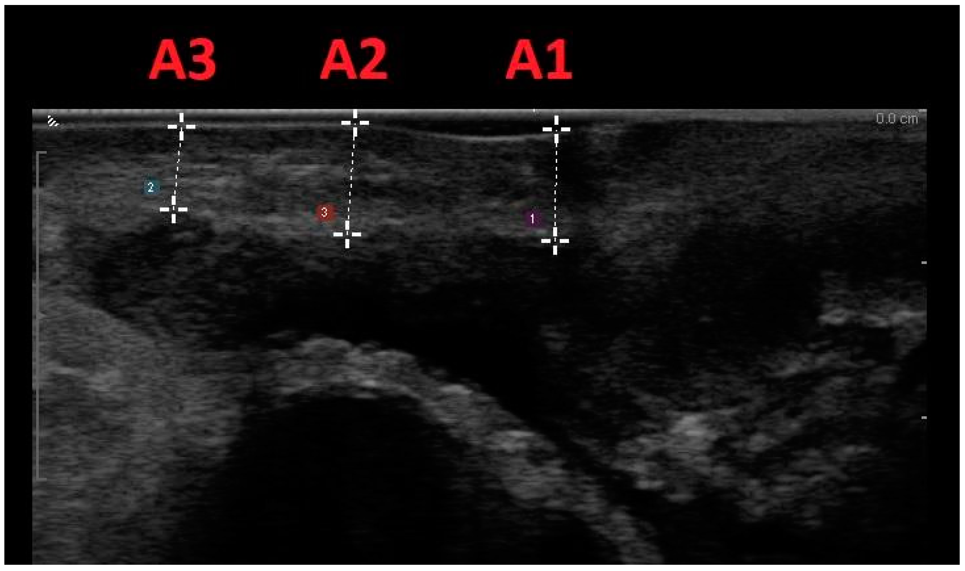 Medicina 60 00370 g002