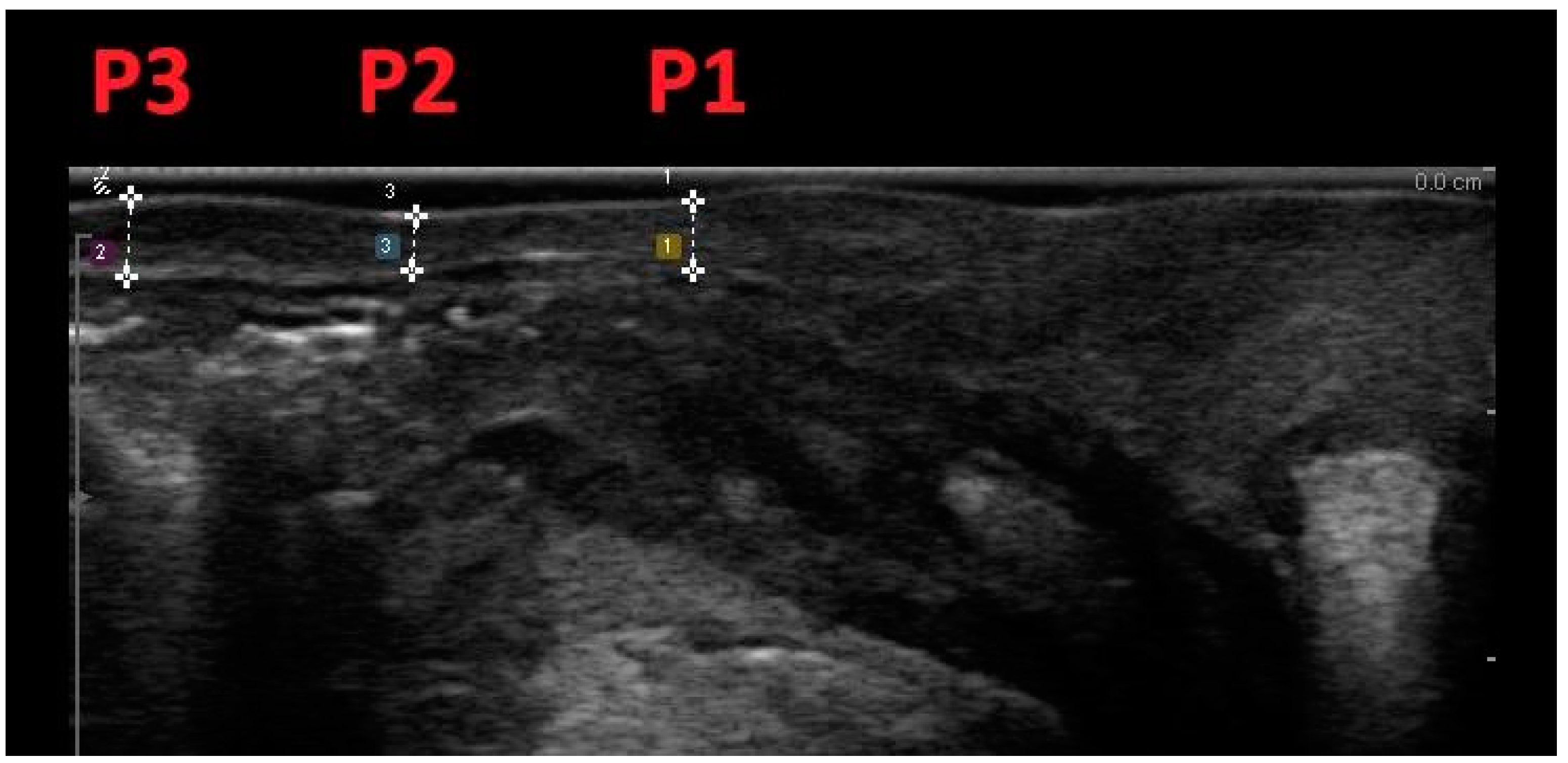 Medicina 60 00370 g003