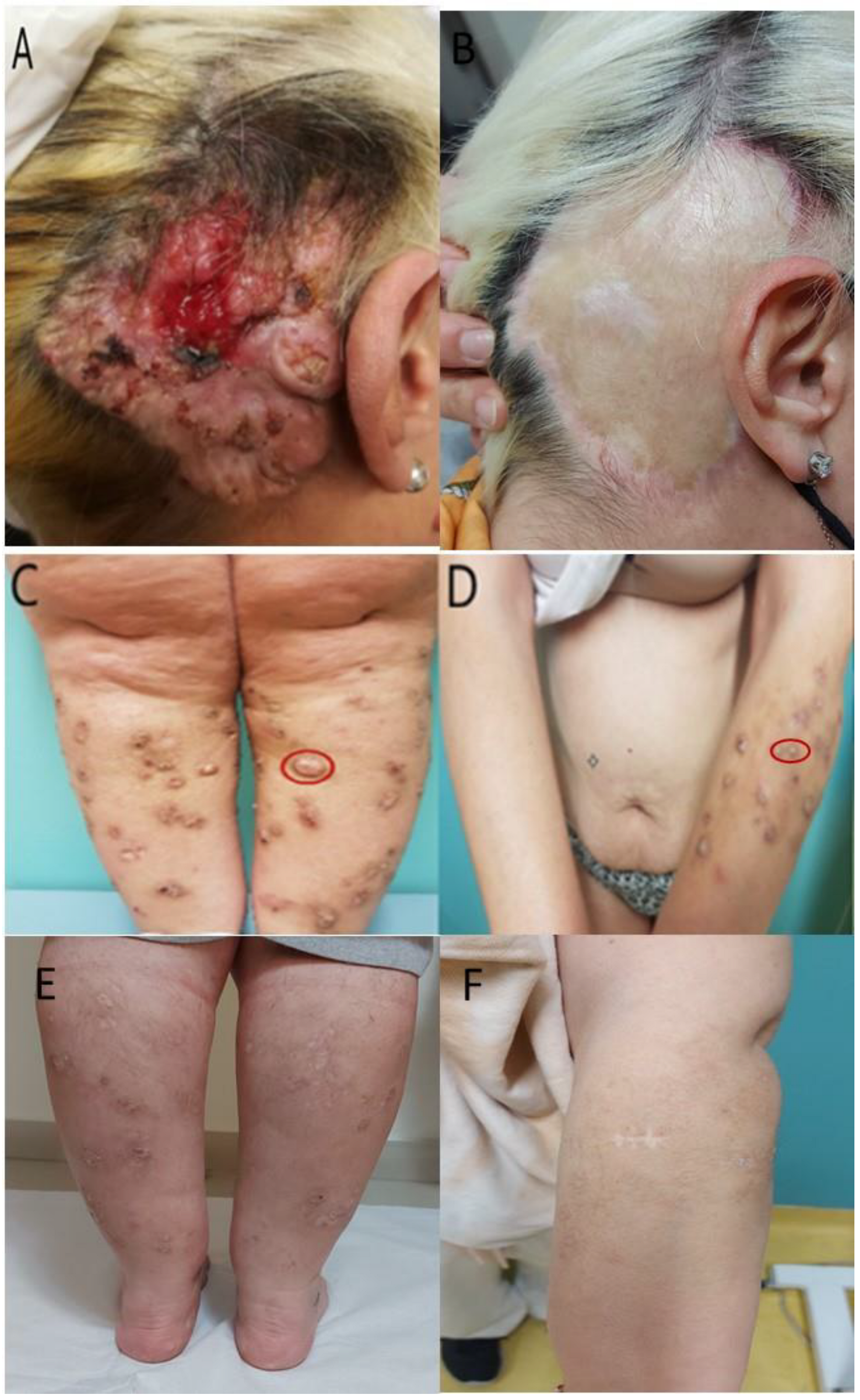 Medicina 60 00371 g001 Medicina 60 00371 g001