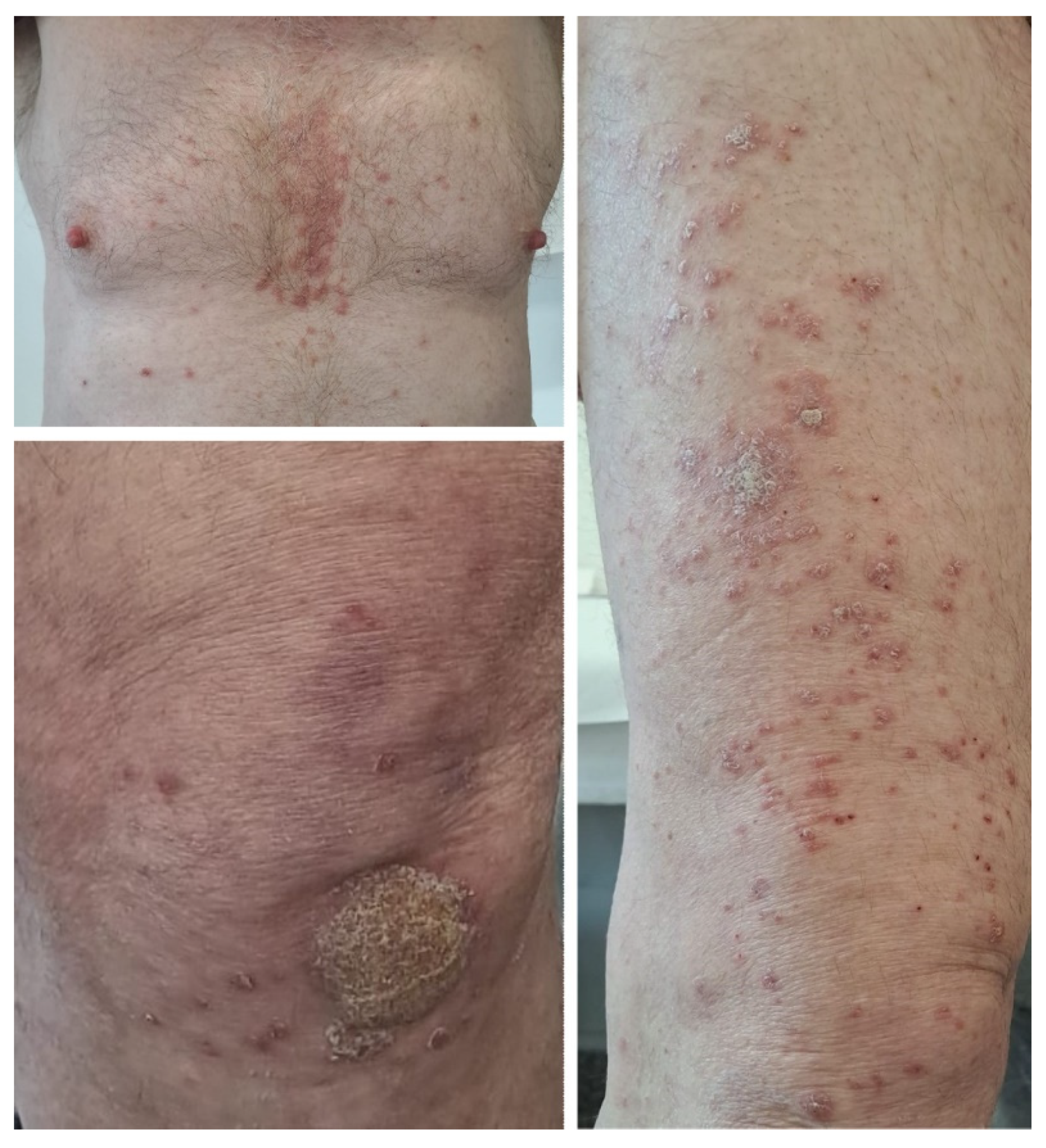 Medicina 60 00373 g002